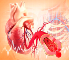 Cardiovascular Diseases