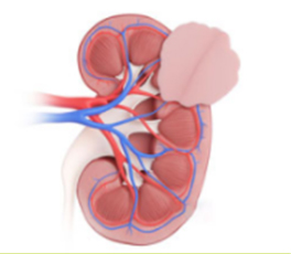 Kidney Disease