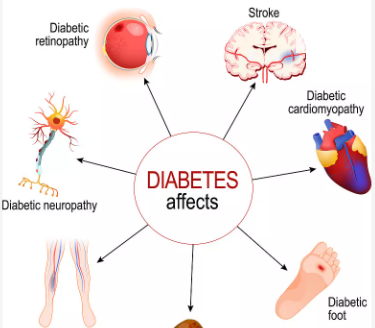 Diabetes