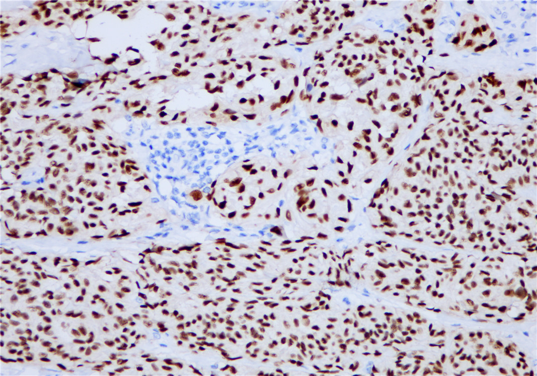 Pathological Antibodies