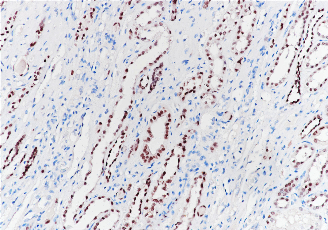 Pathological Antibodies