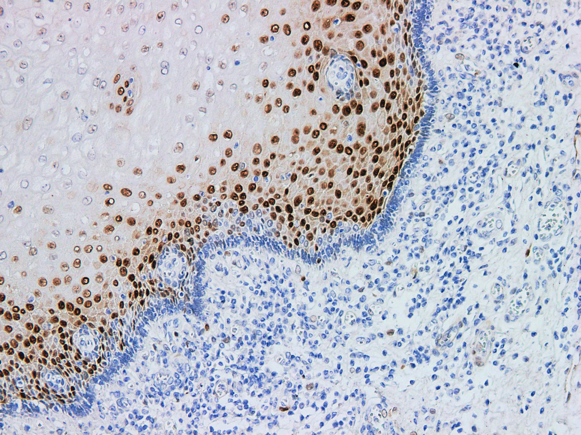 Pathological Antibodies