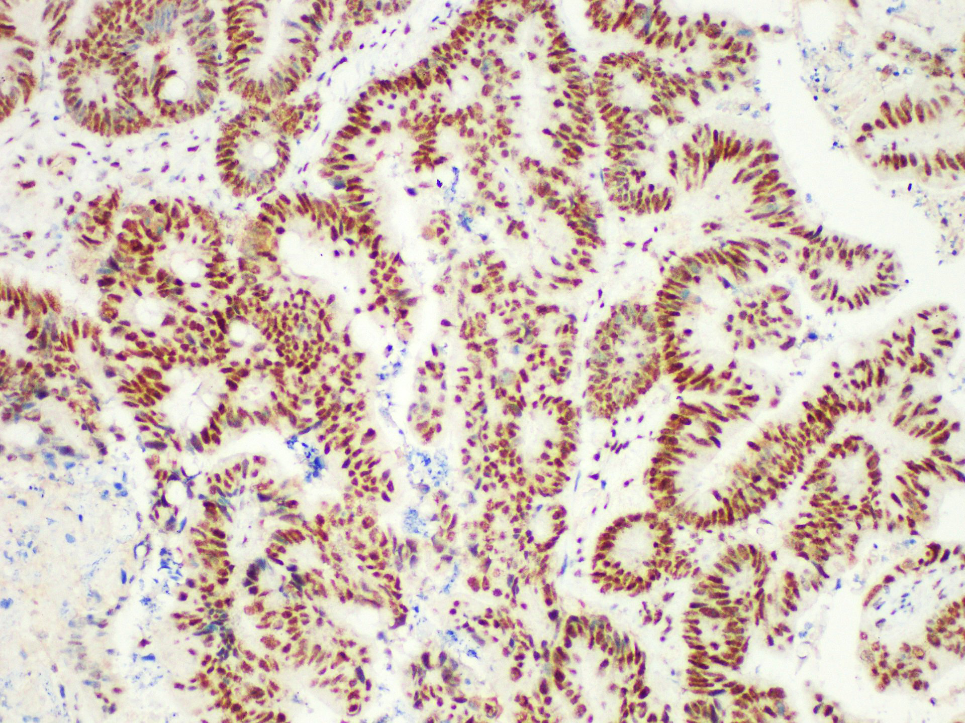 Pathological Antibodies