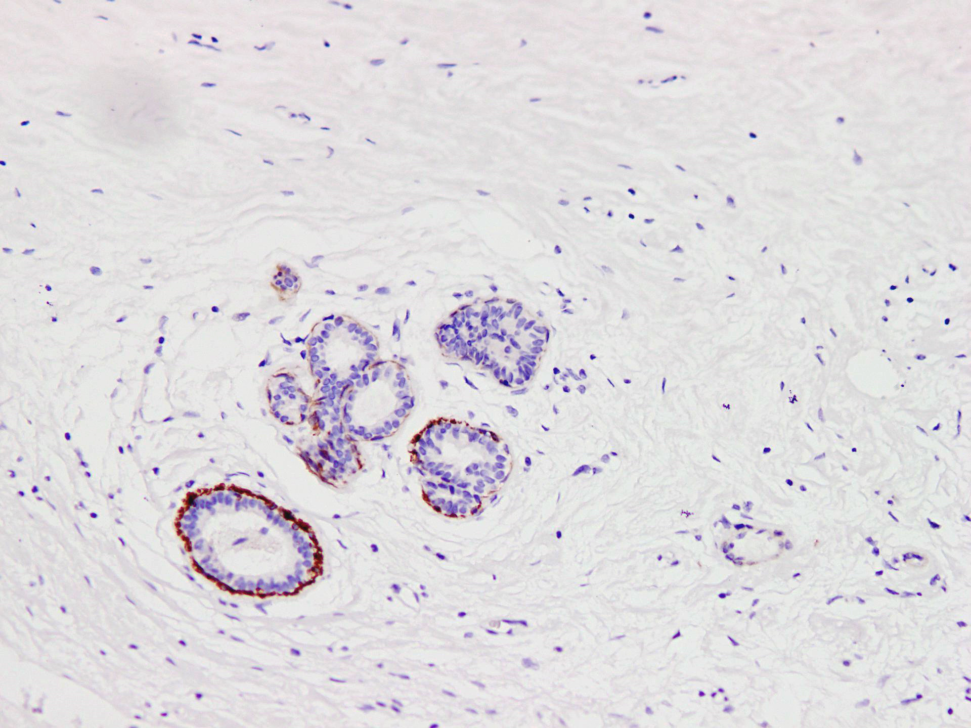 Pathological Antibodies