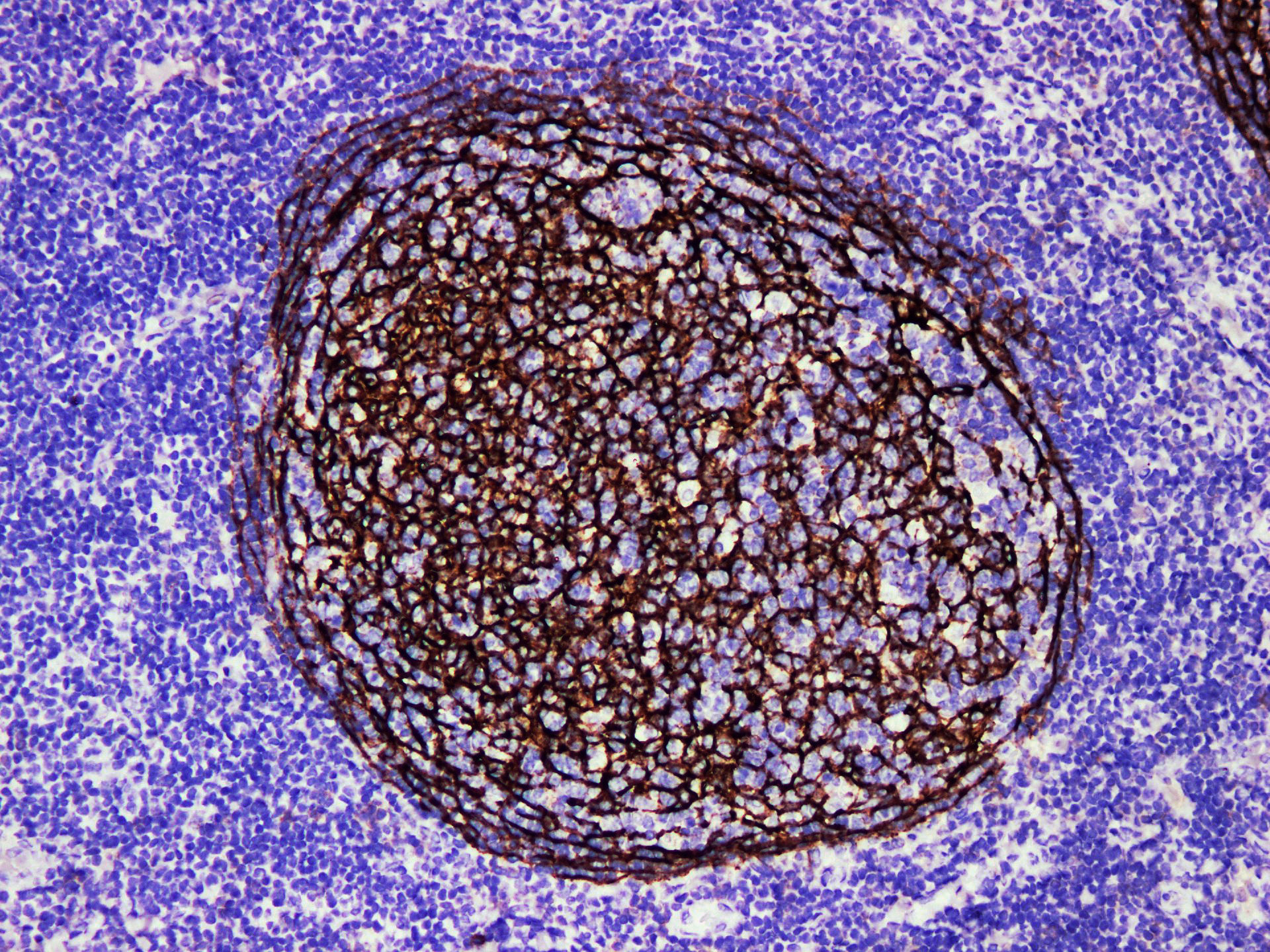 Pathological Antibodies