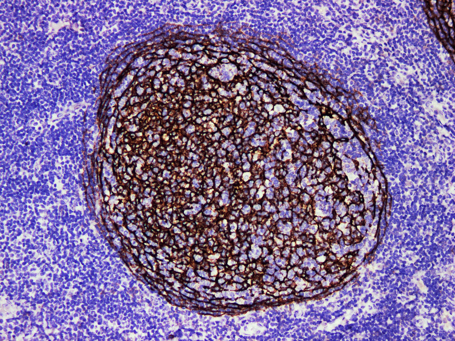 Pathological Antibodies