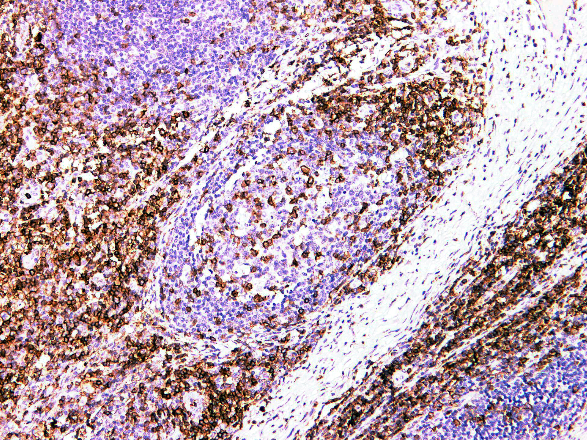 Pathological Antibodies