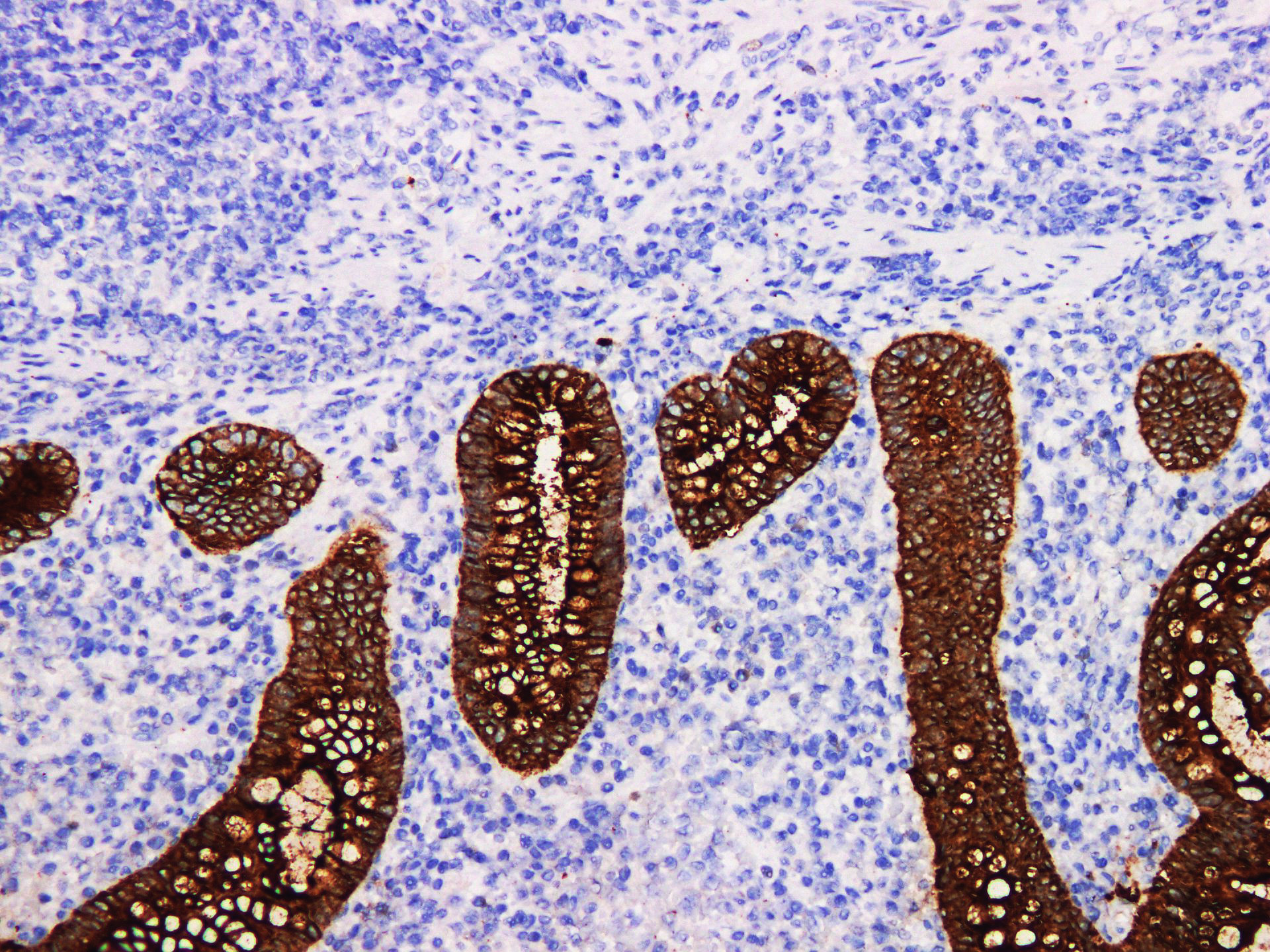 Pathological Antibodies