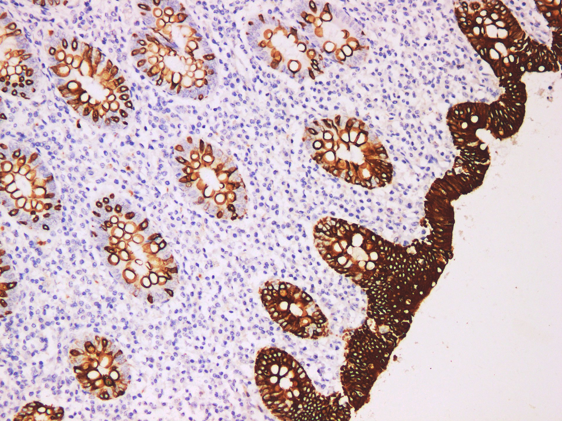 Pathological Antibodies