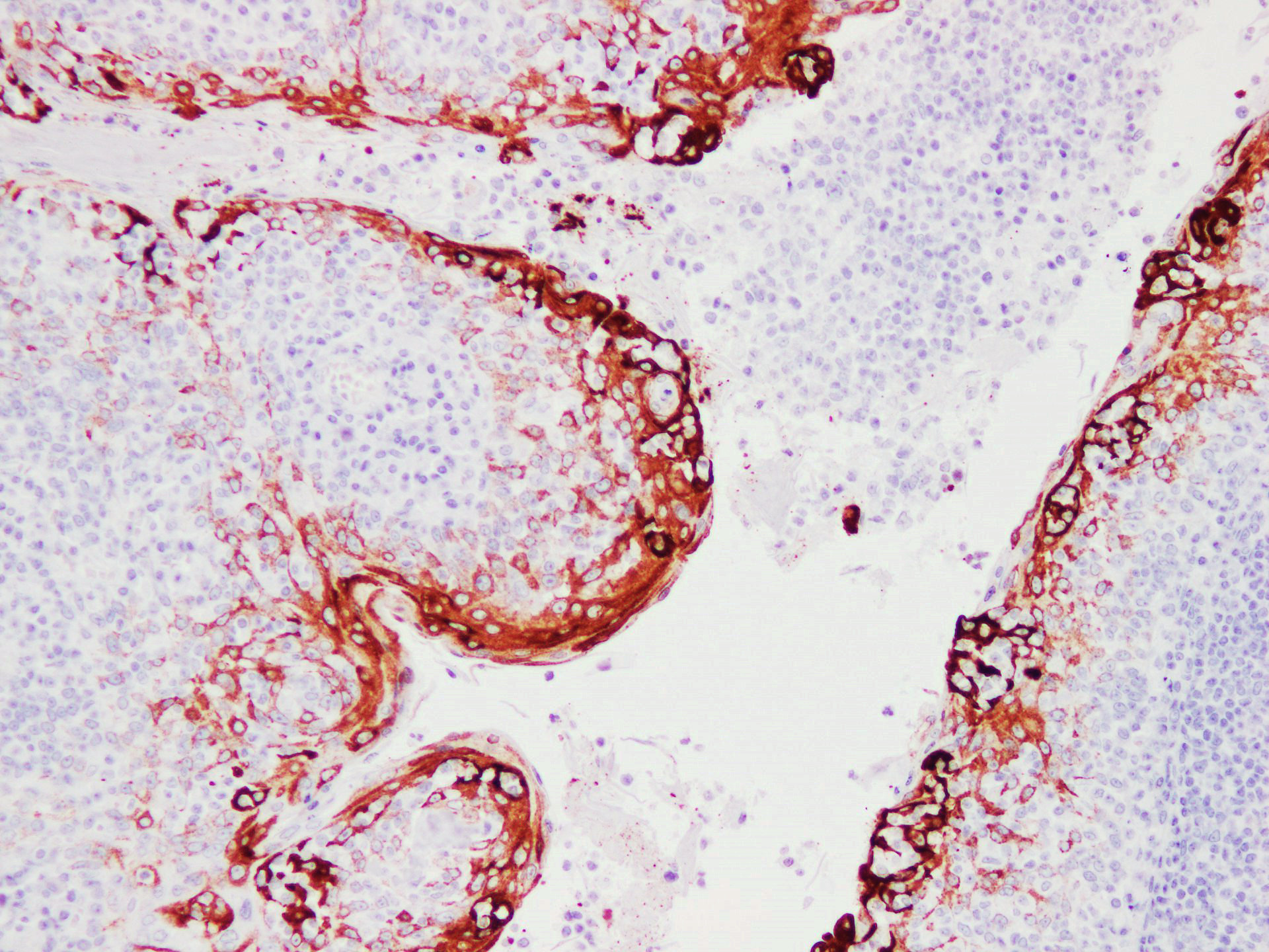 Pathological Antibodies