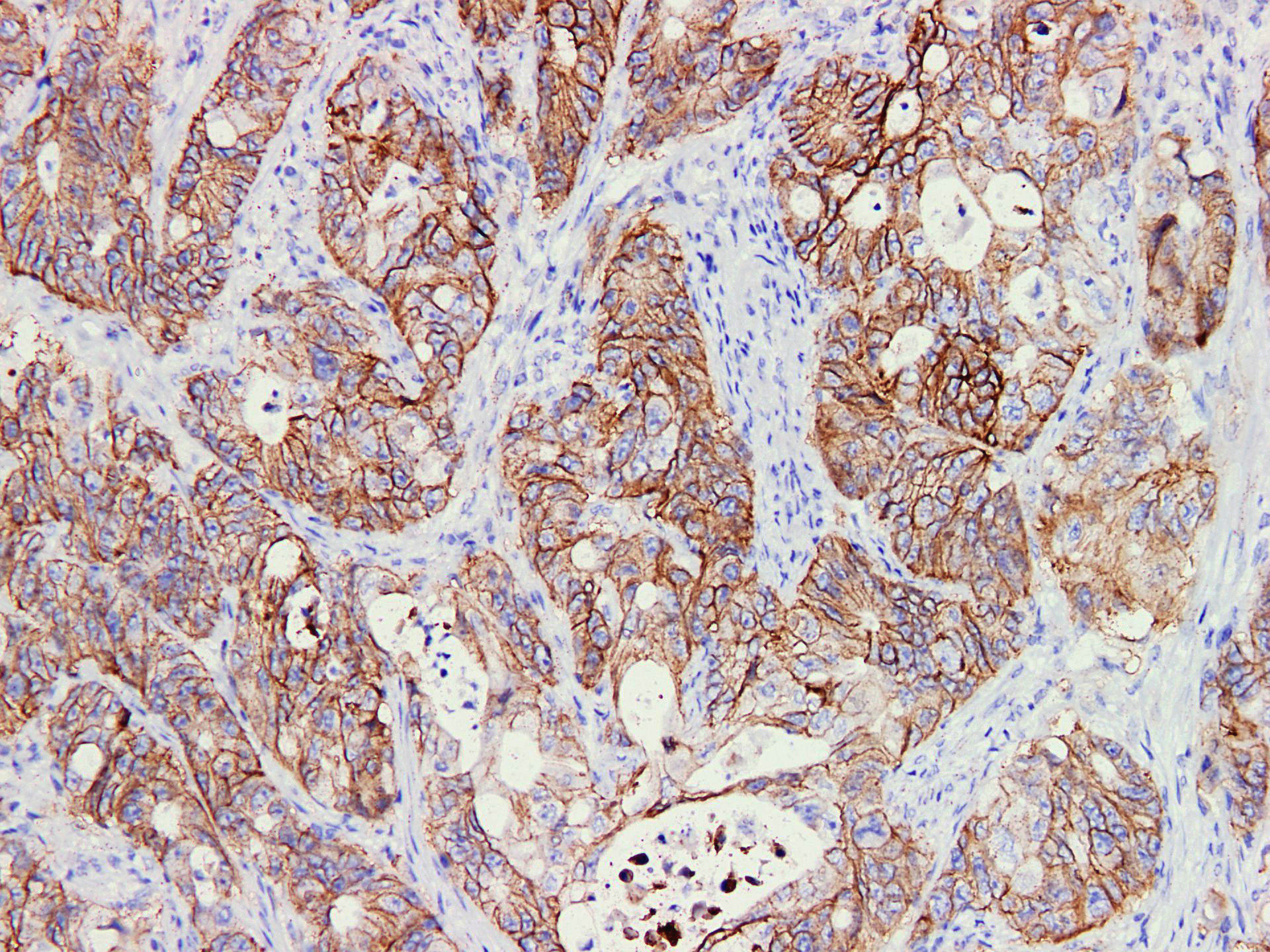 Pathological Antibodies