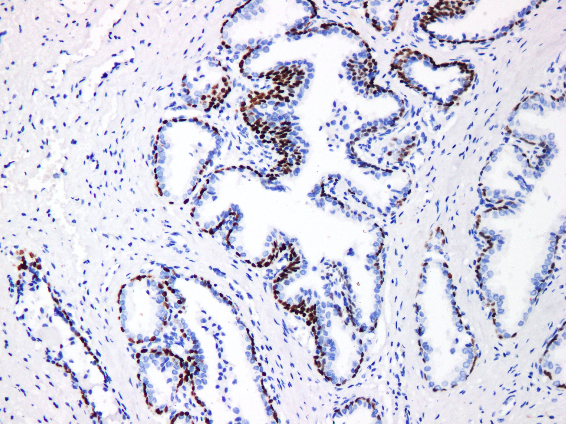 Pathological Antibodies