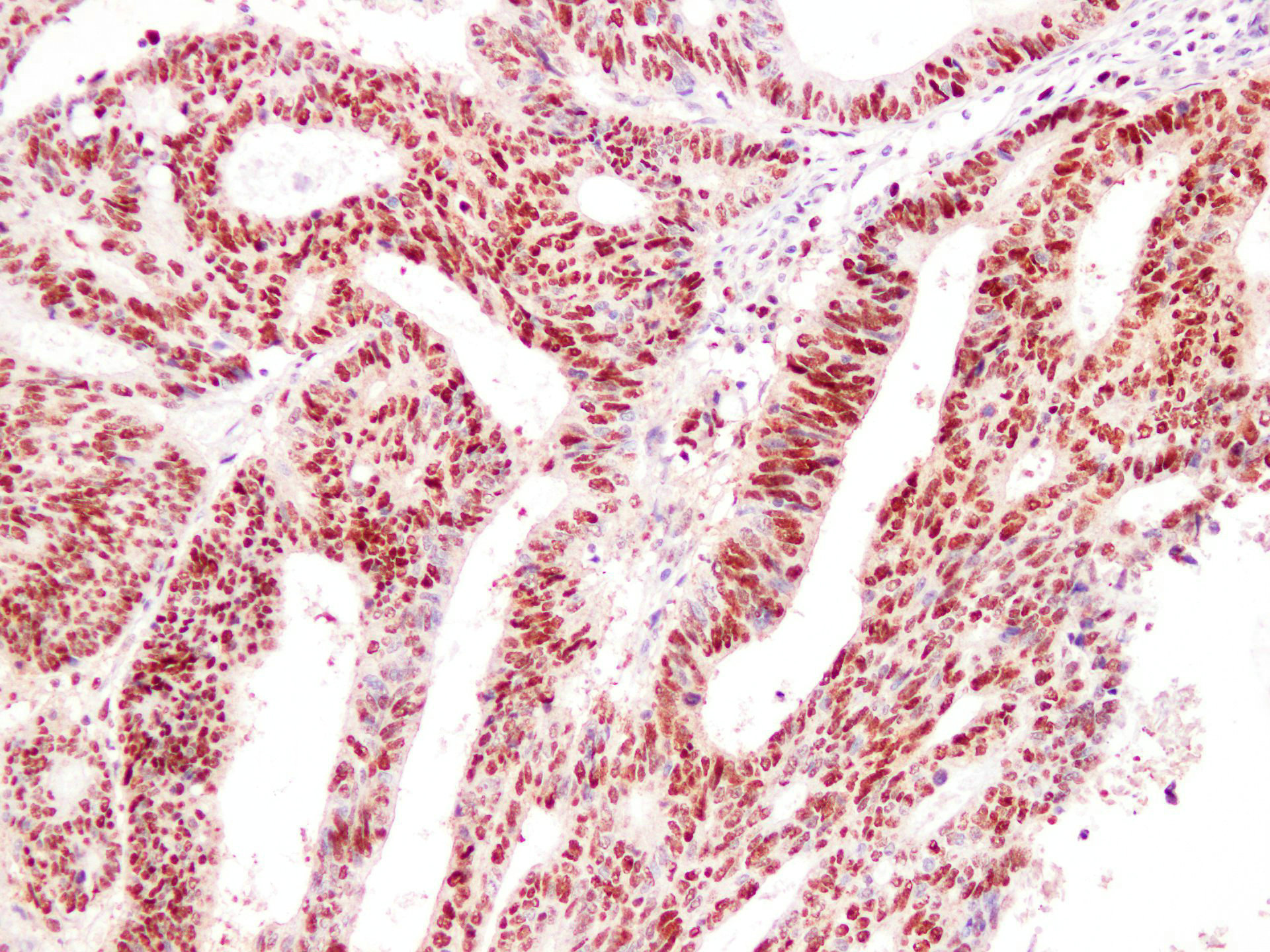 Pathological Antibodies