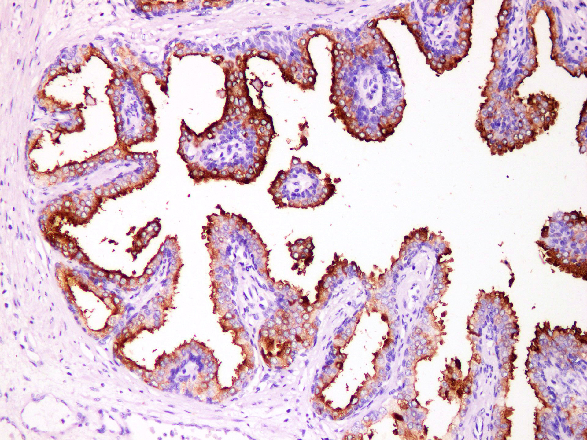 Pathological Antibodies