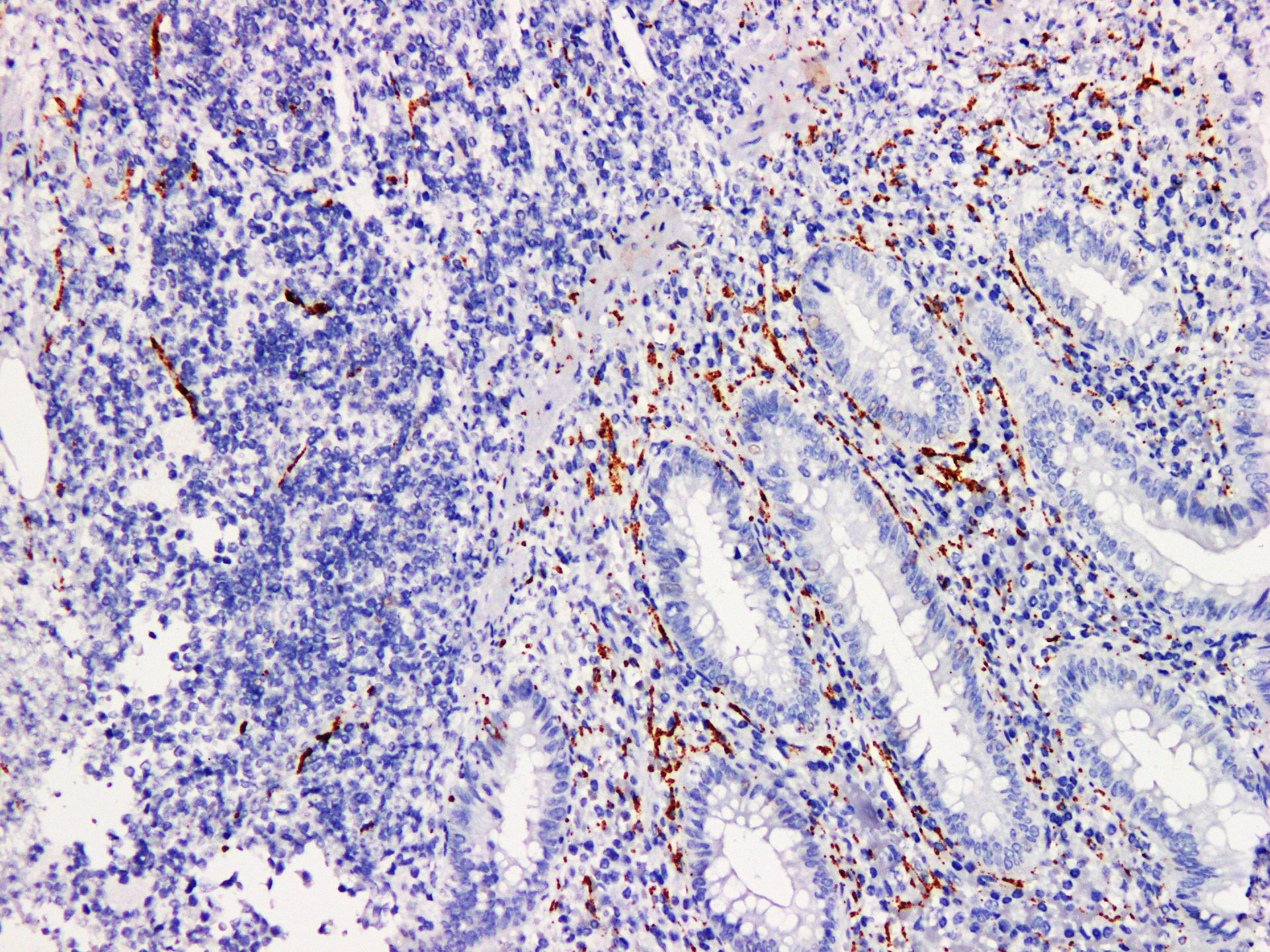 Pathological Antibodies