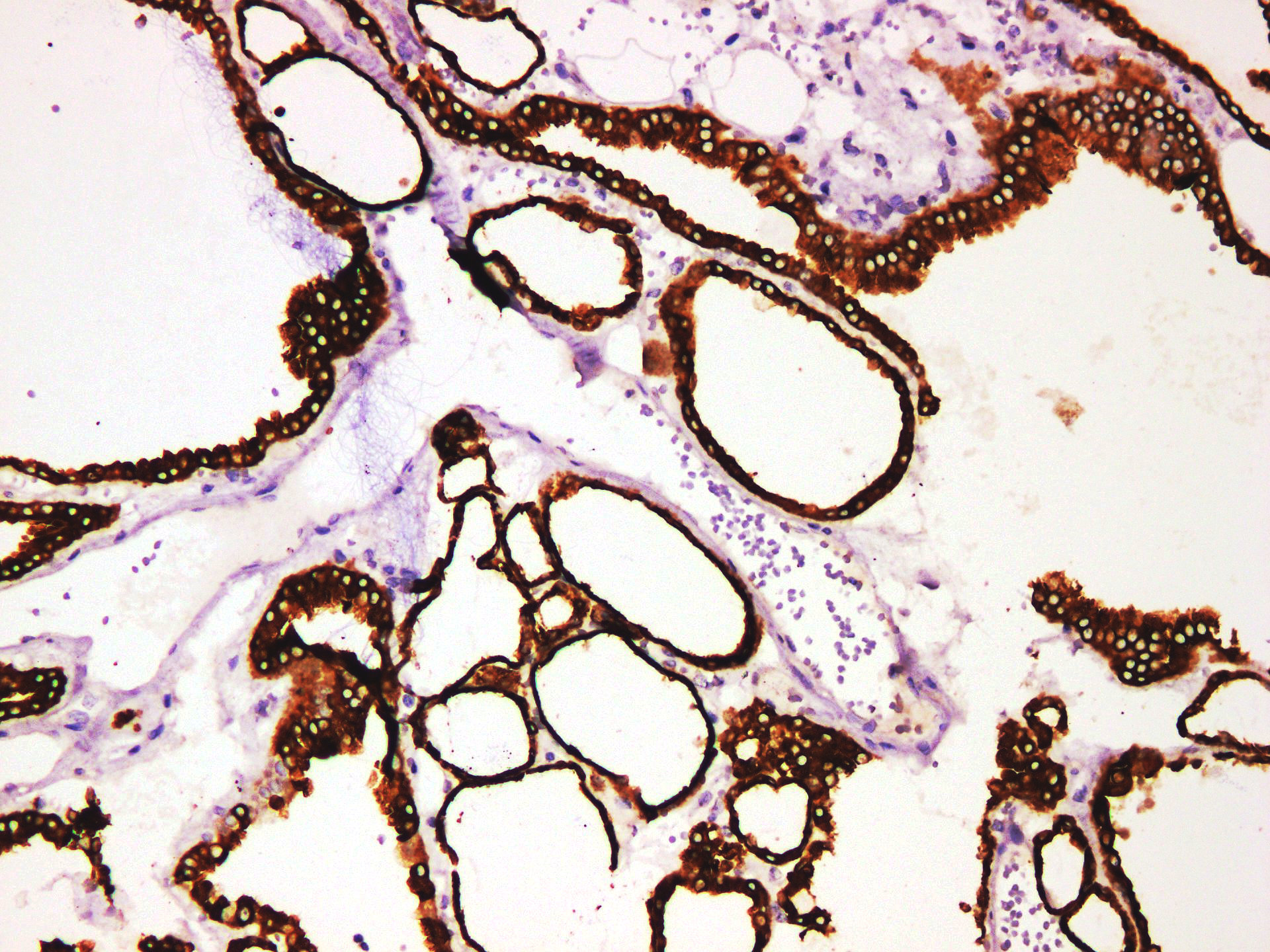 Pathological Antibodies