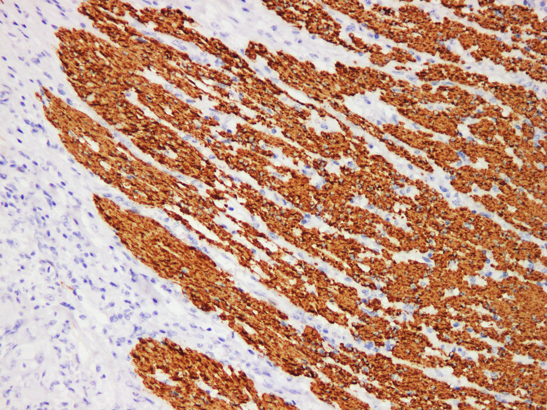 Pathological Antibodies