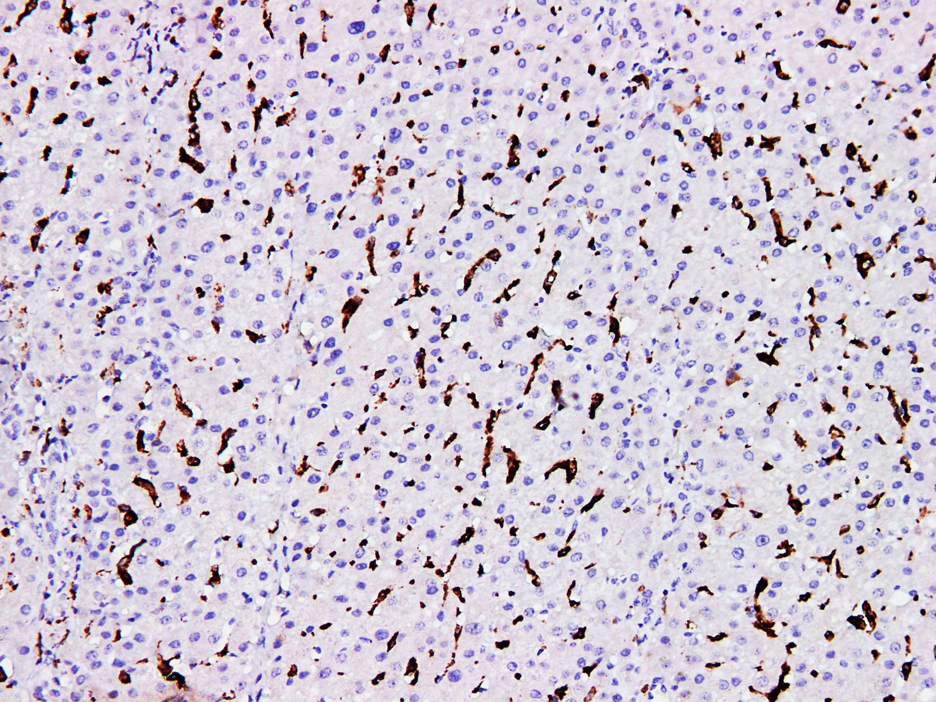 Pathological Antibodies