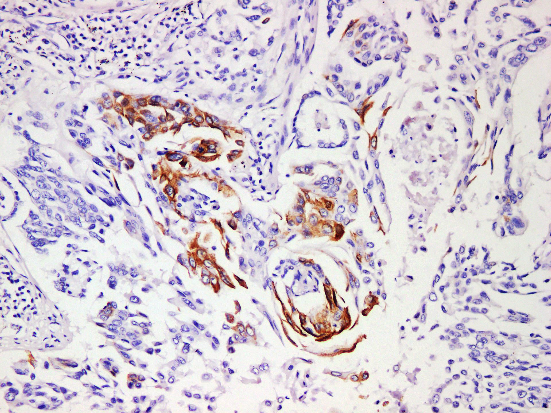 Pathological Antibodies