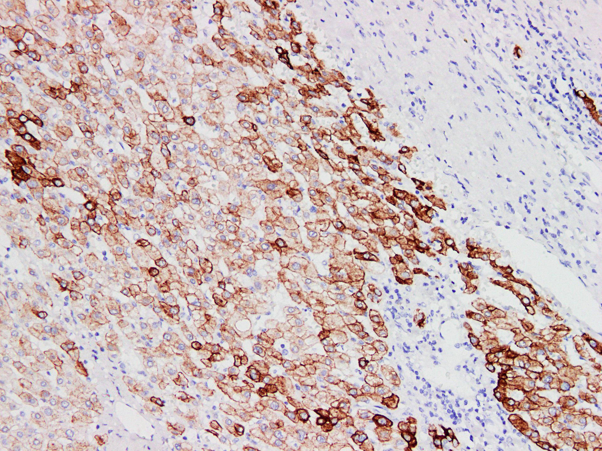 Pathological Antibodies