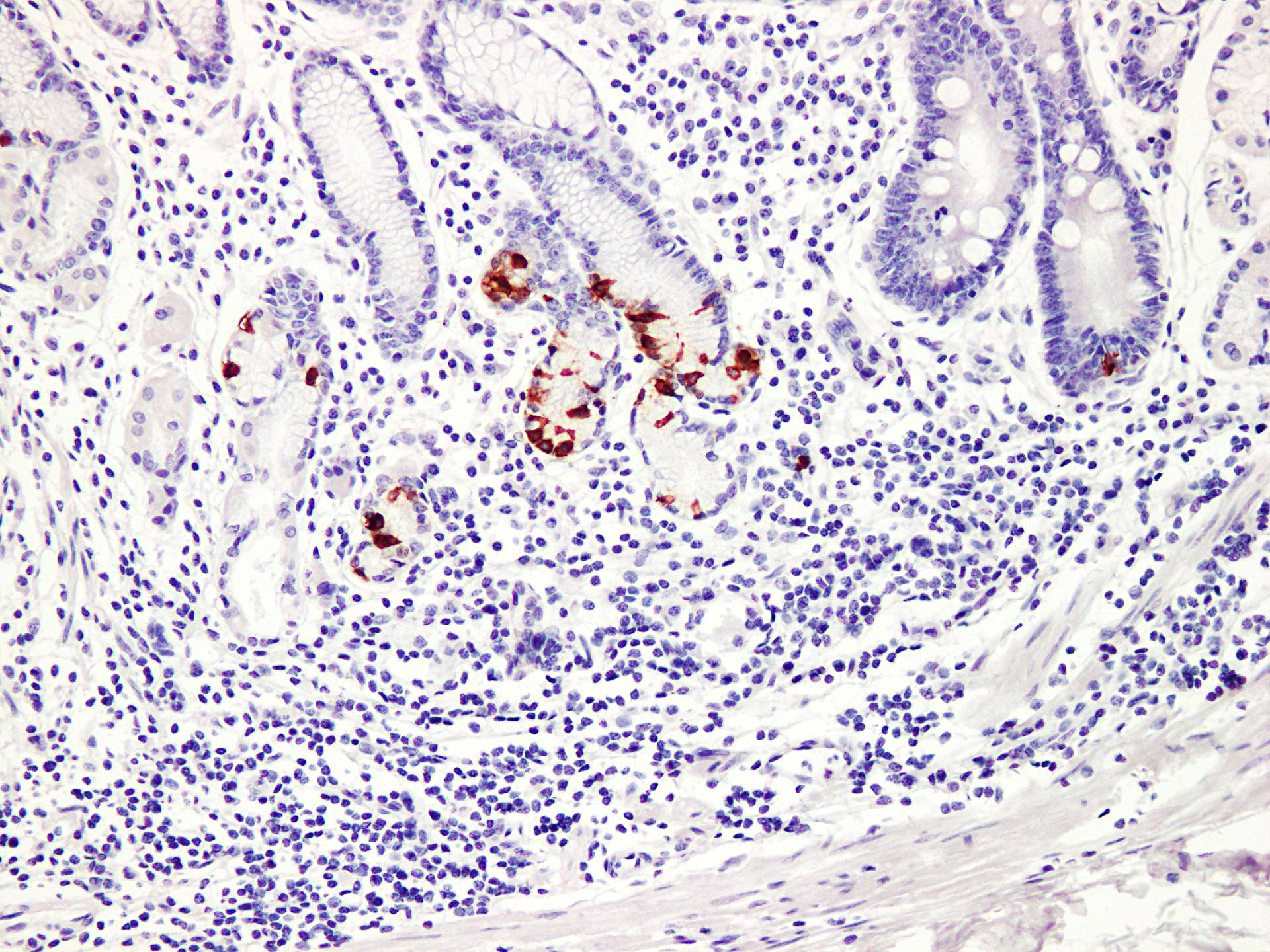 Pathological Antibodies