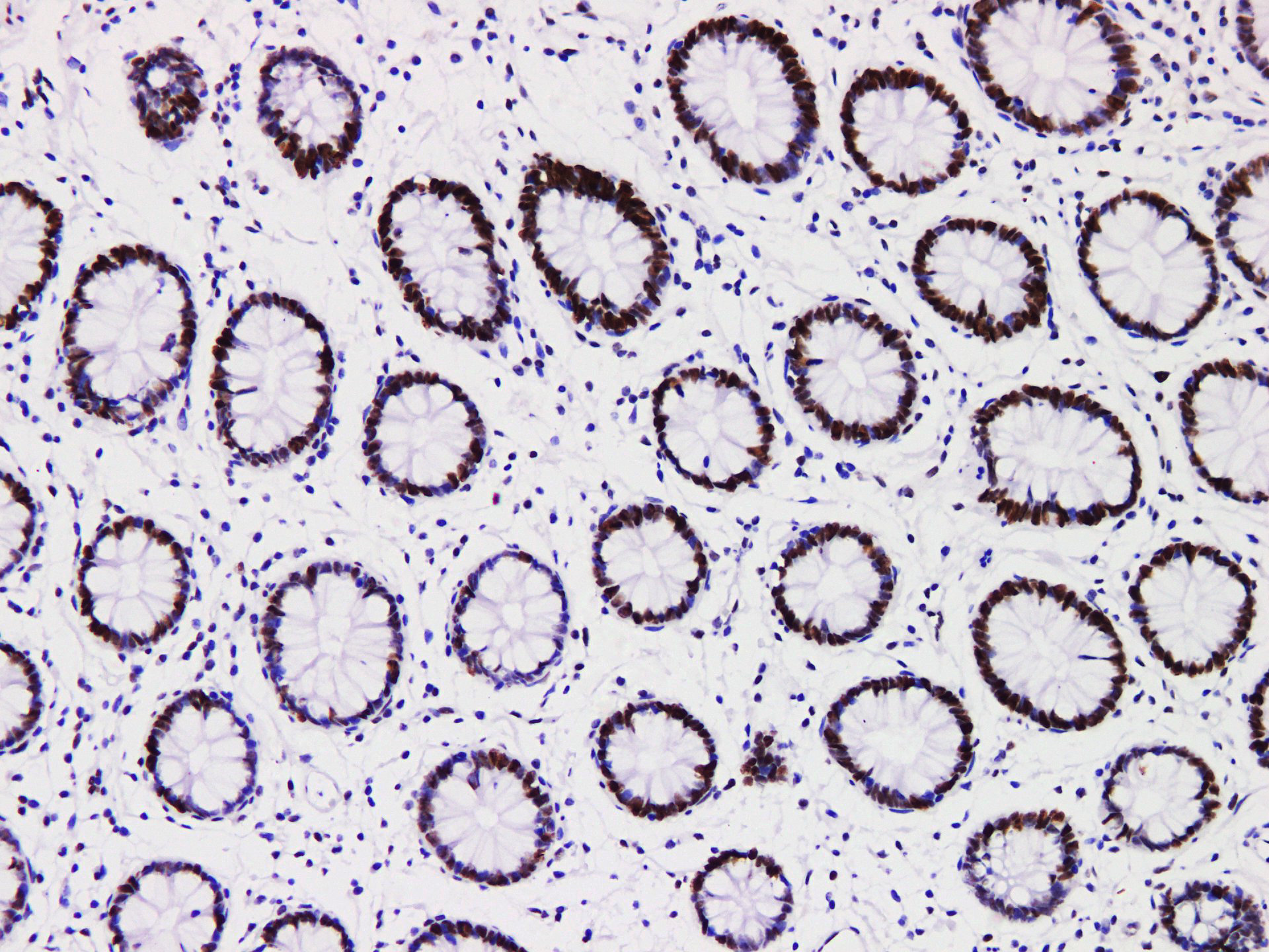 Pathological Antibodies