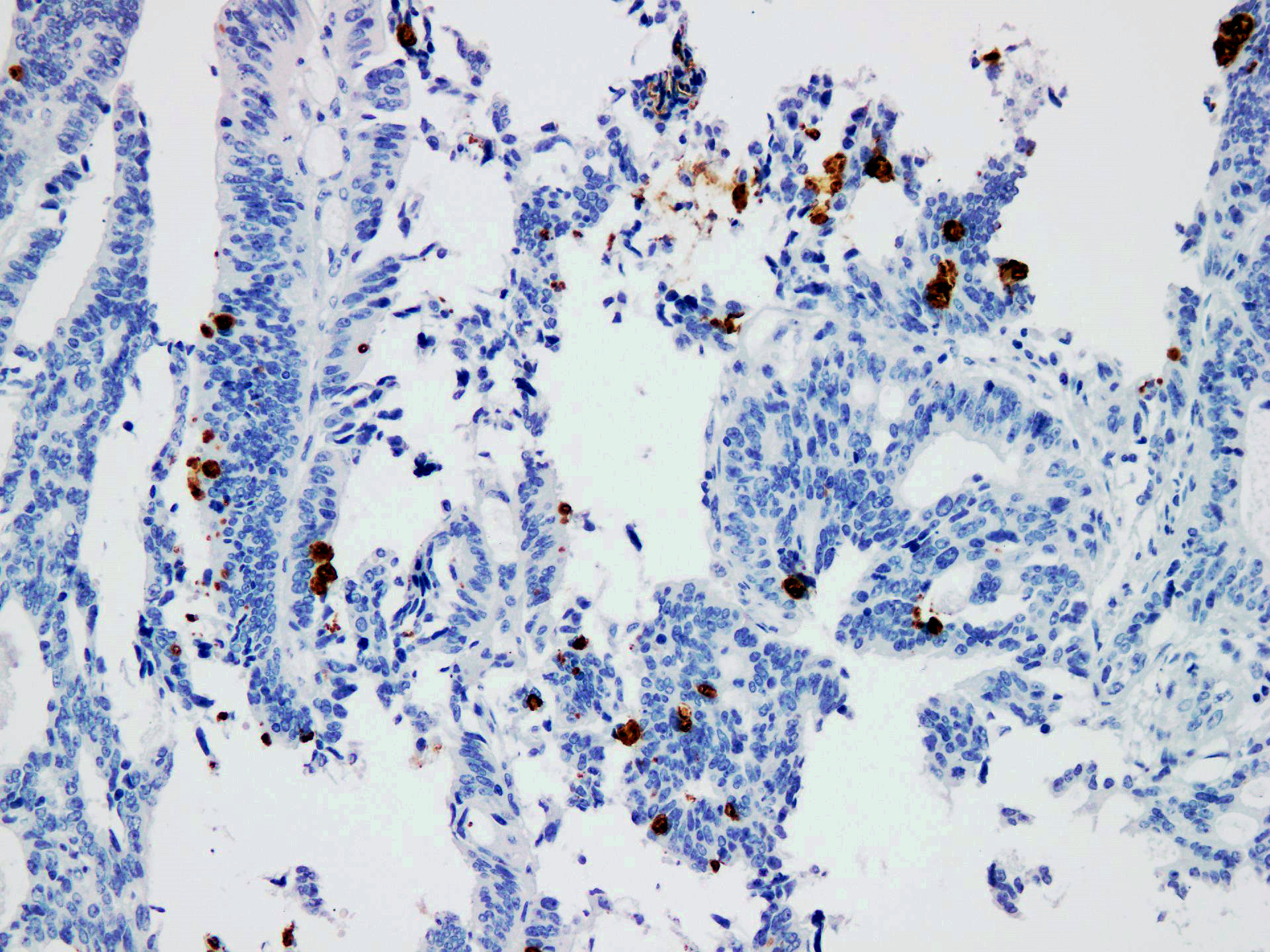 Pathological Antibodies