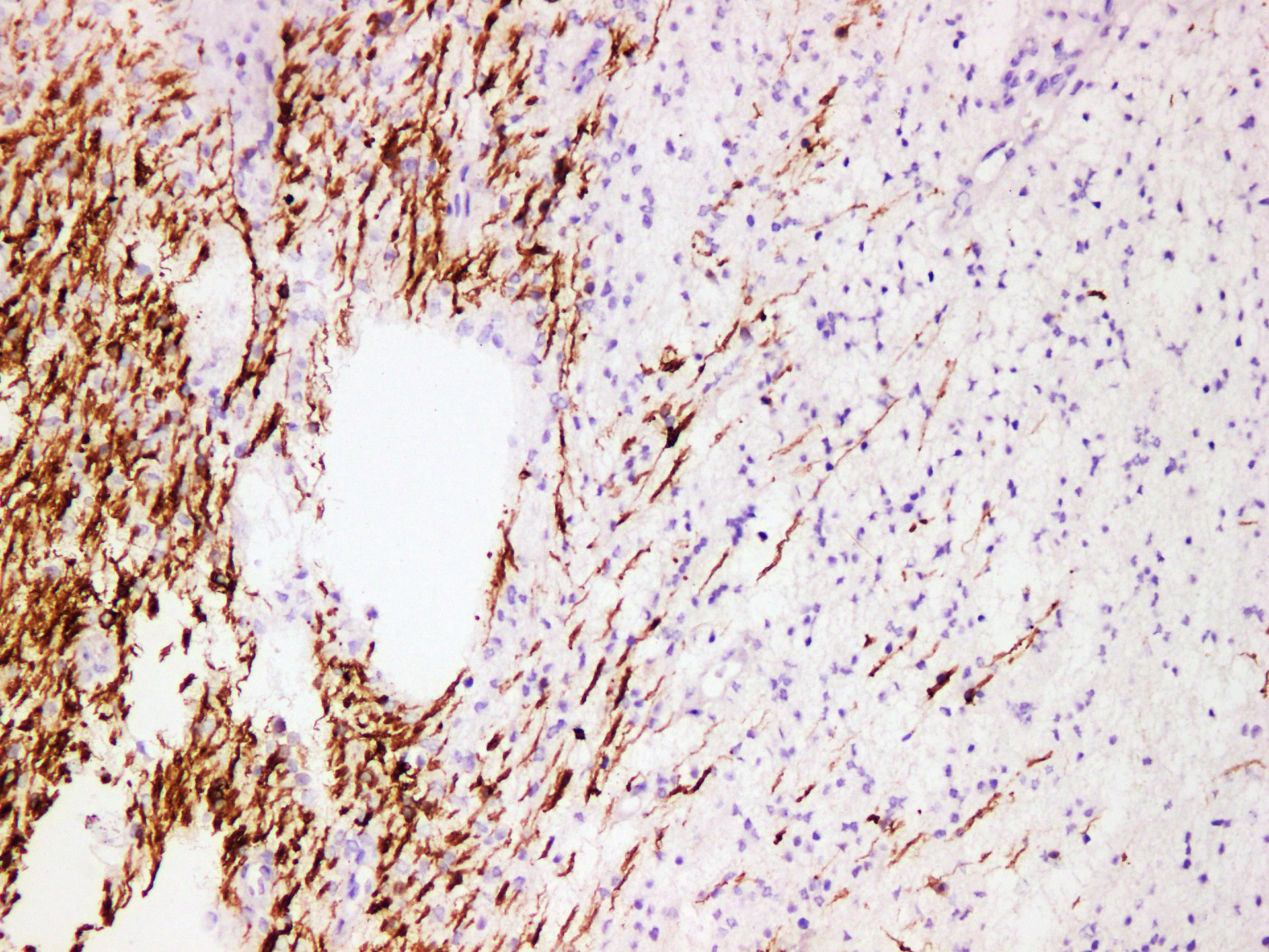 Pathological Antibodies