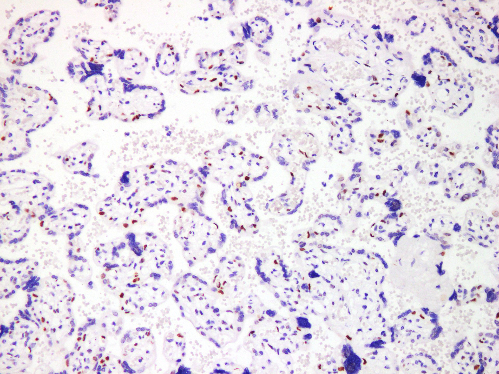 Pathological Antibodies