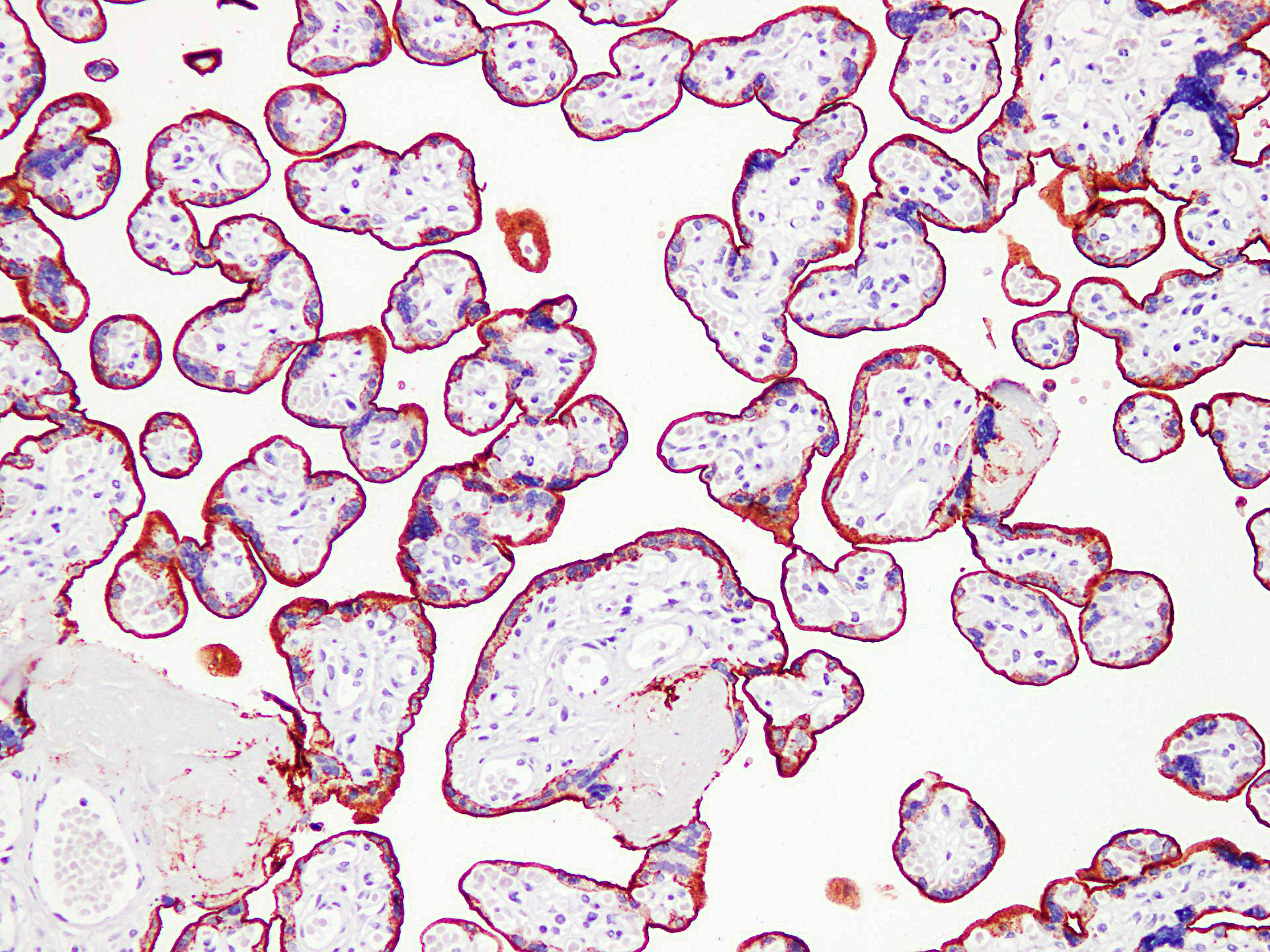 Pathological Antibodies