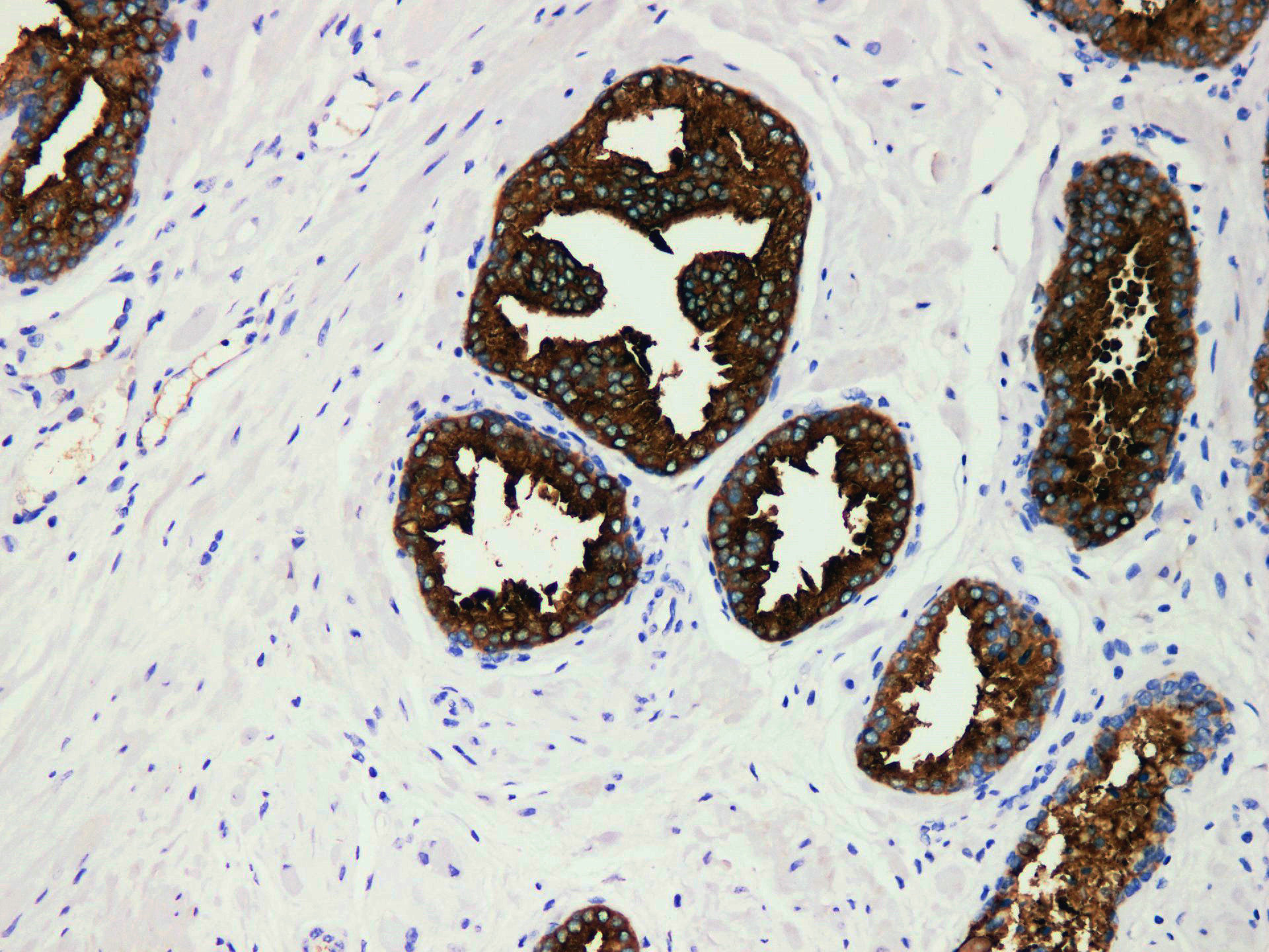 Pathological Antibodies