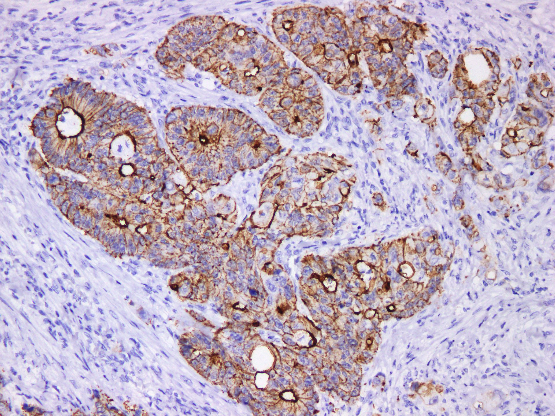 Pathological Antibodies