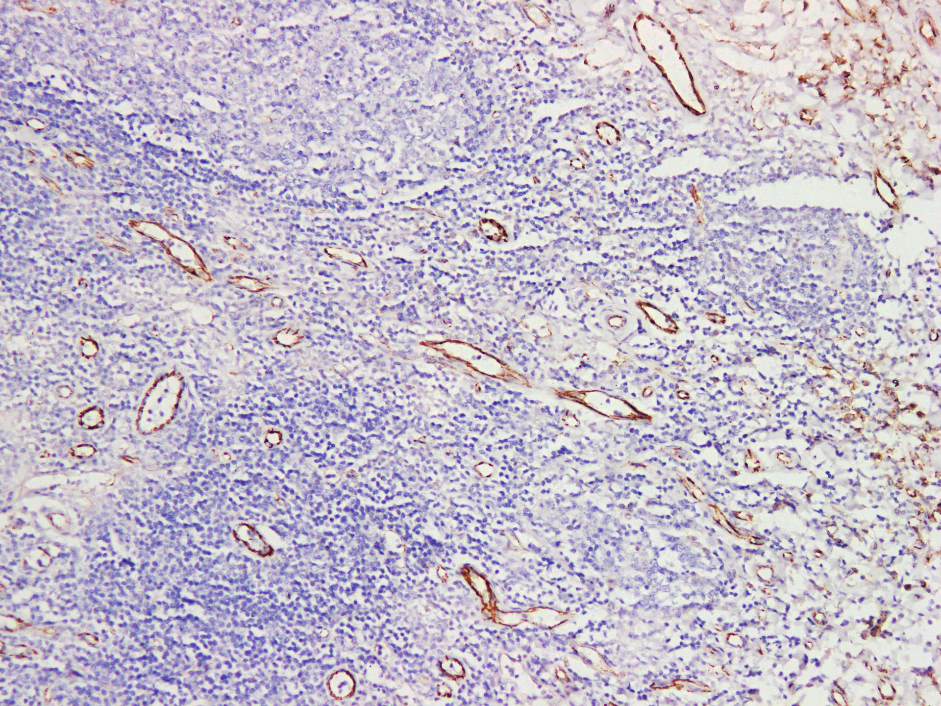 Pathological Antibodies