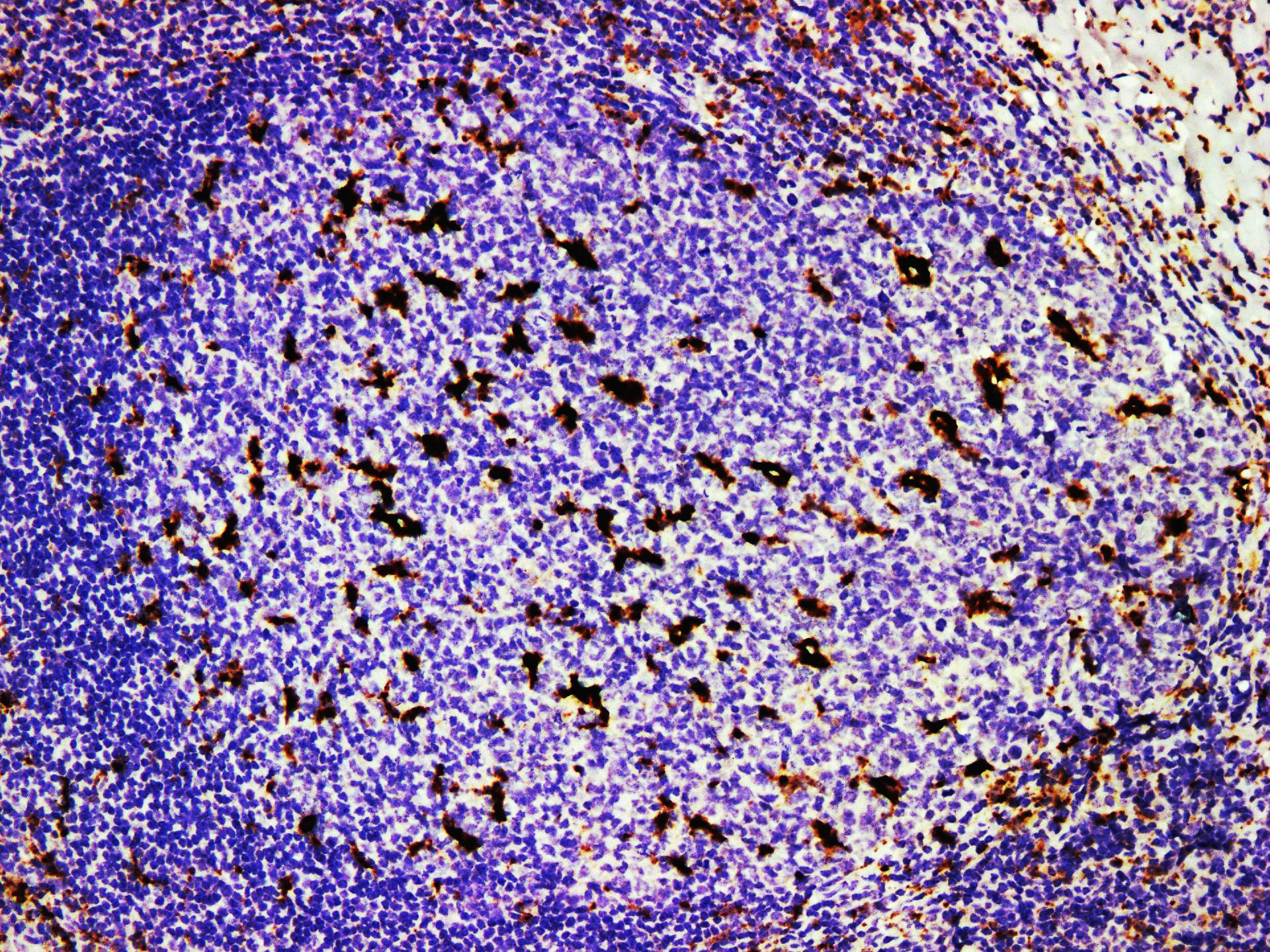 Pathological Antibodies