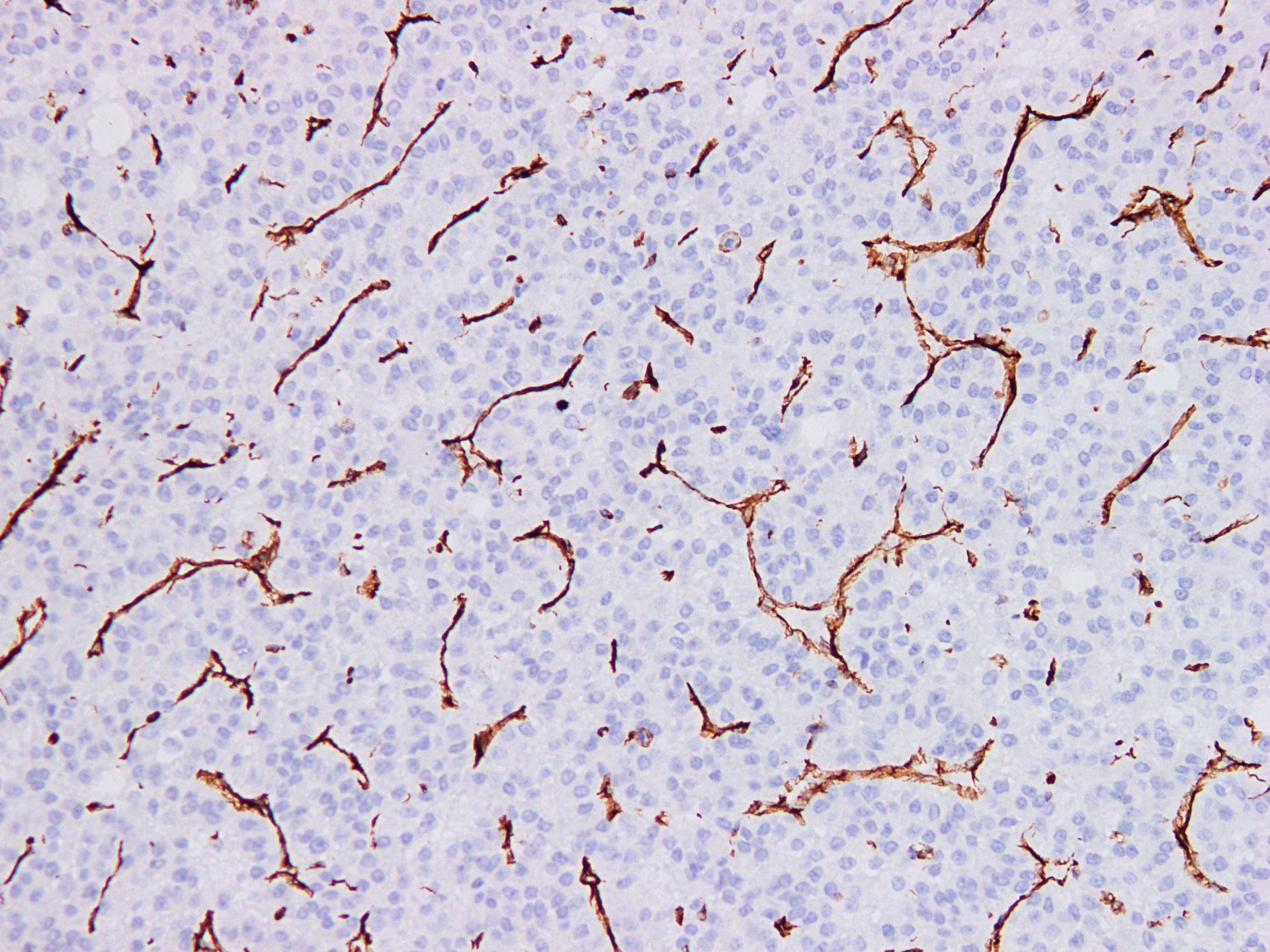 Pathological Antibodies