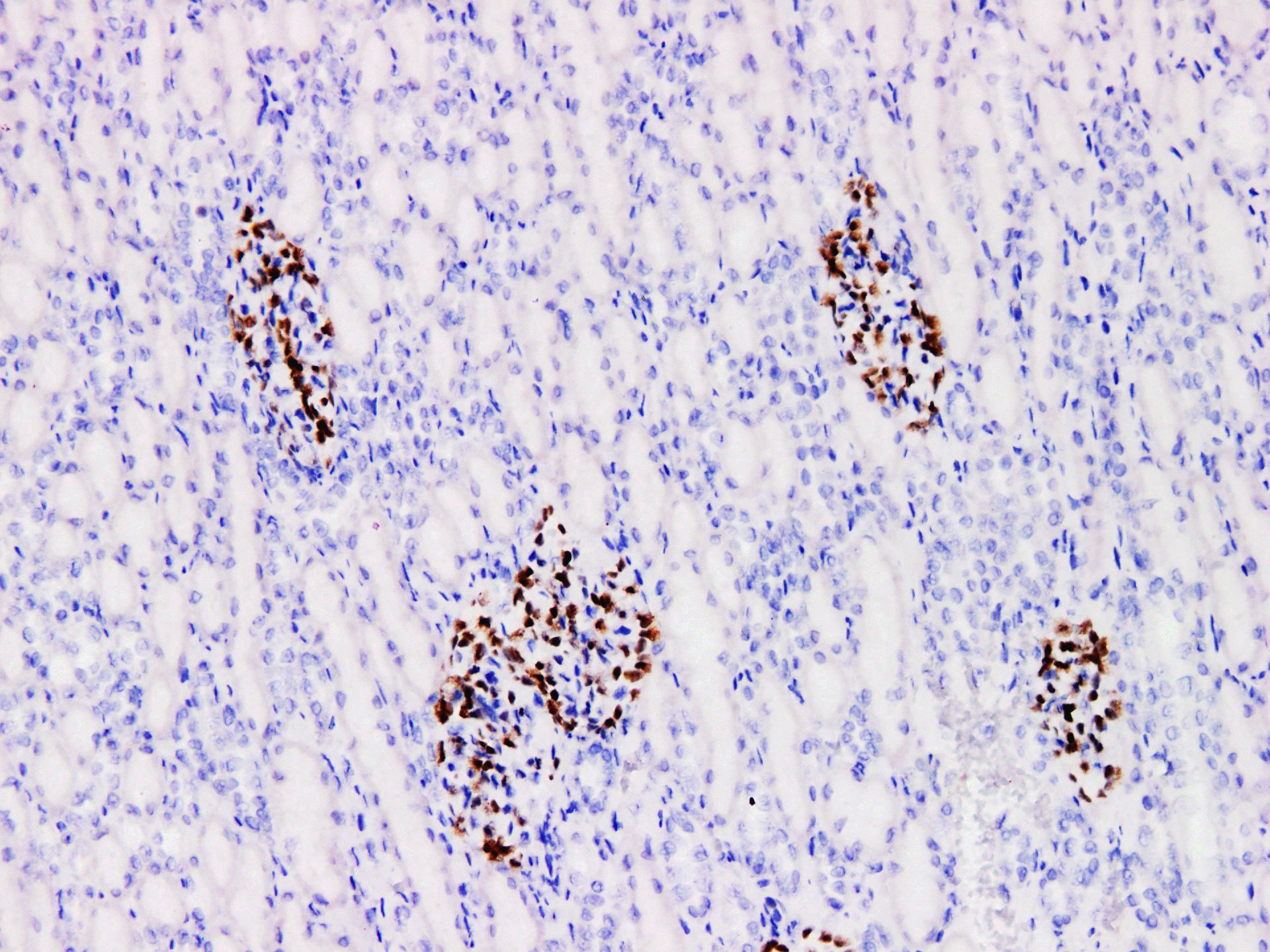 Pathological Antibodies