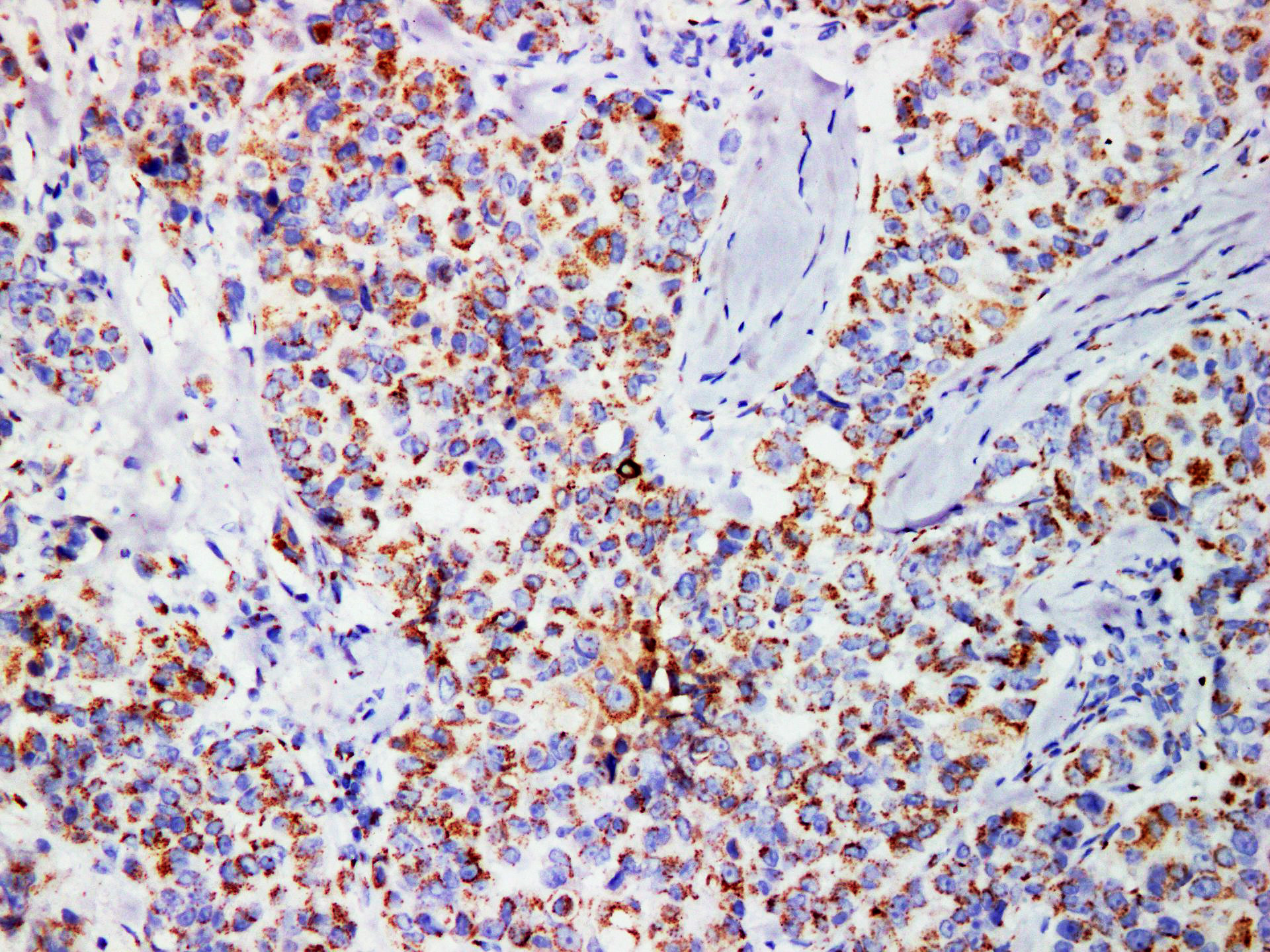 Pathological Antibodies