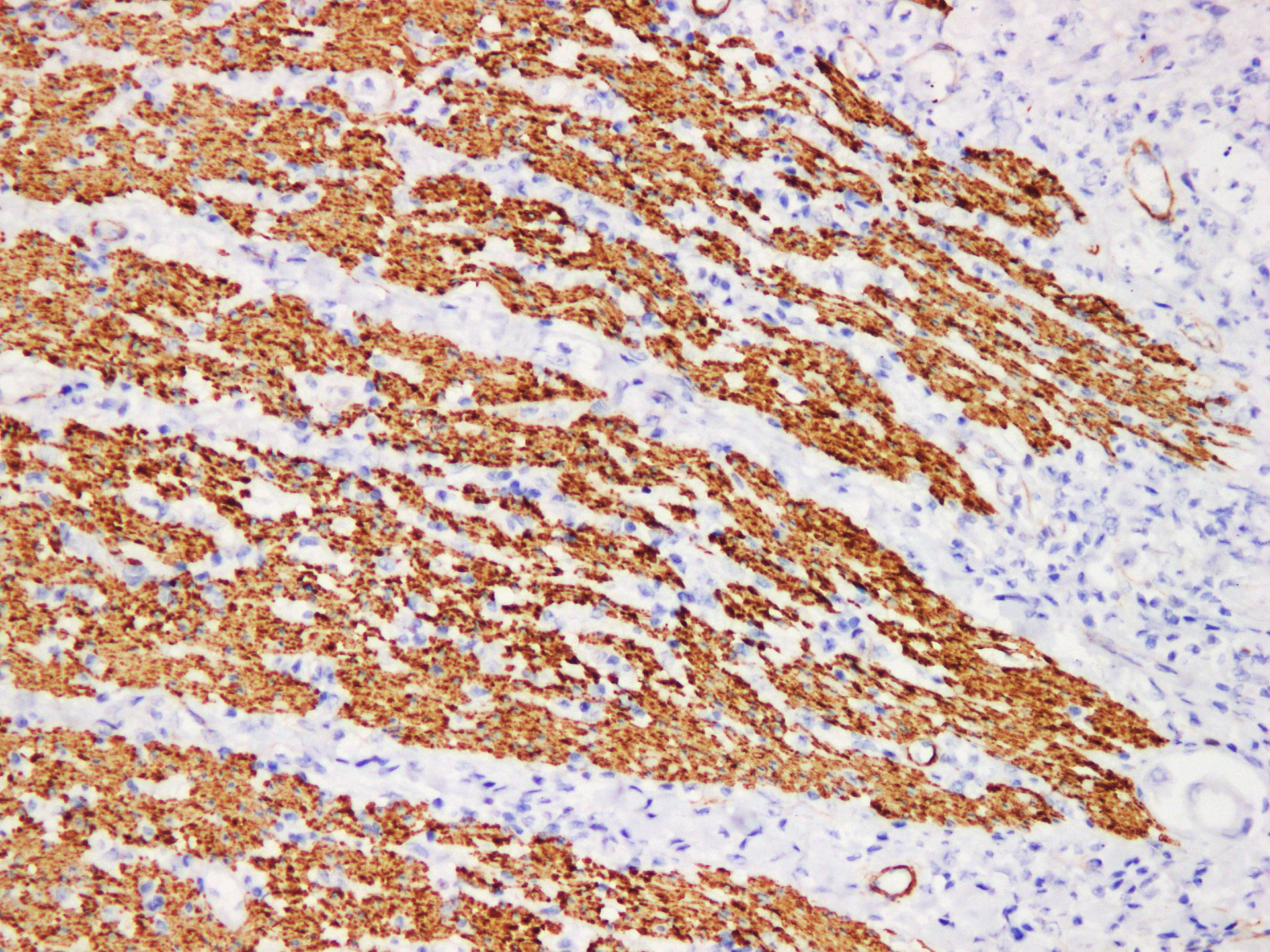 Pathological Antibodies