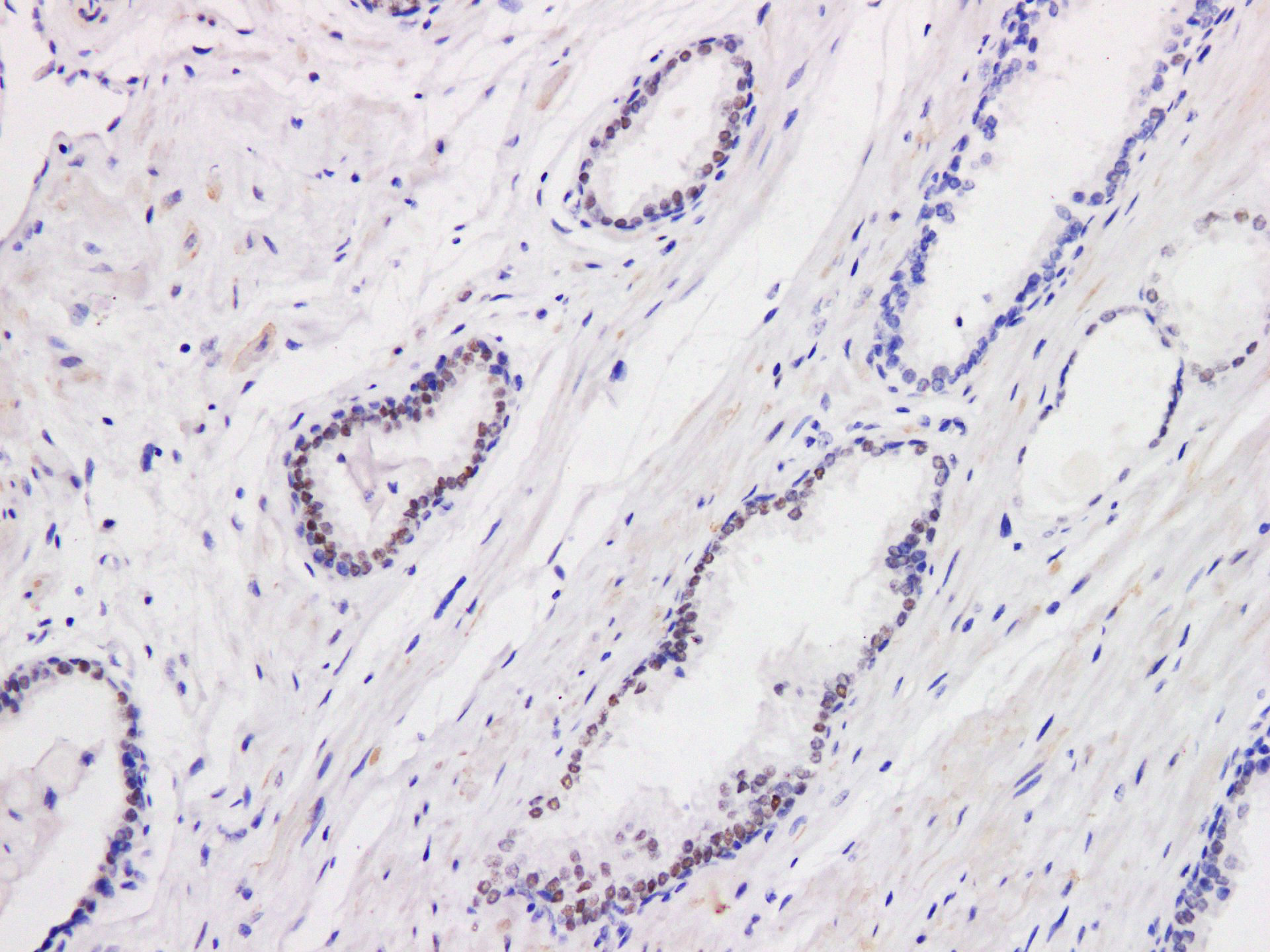 Pathological Antibodies