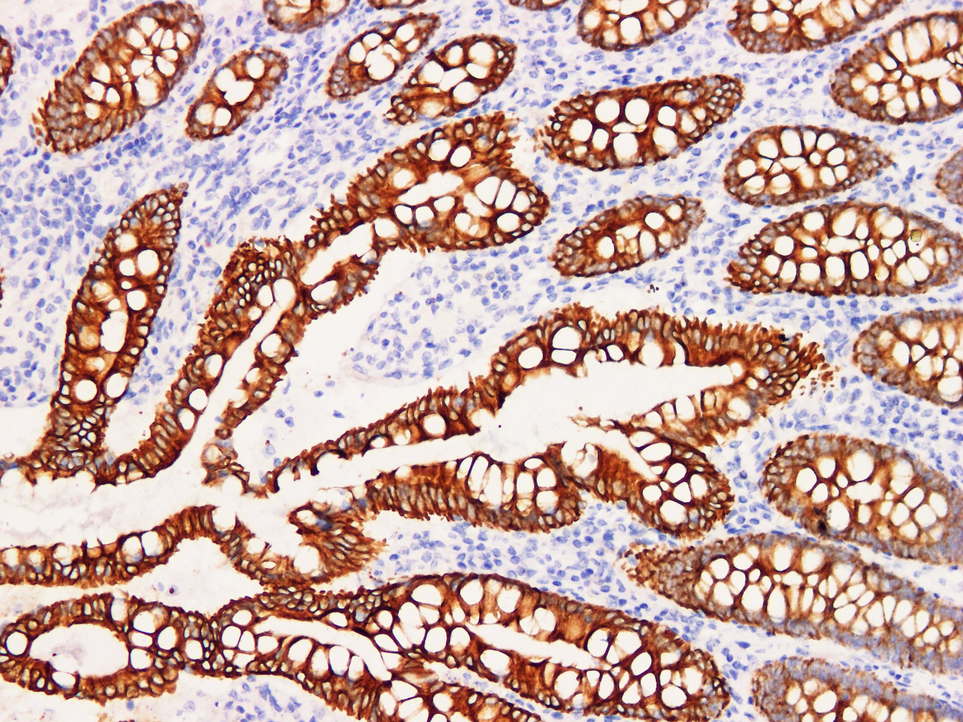 Pathological Antibodies