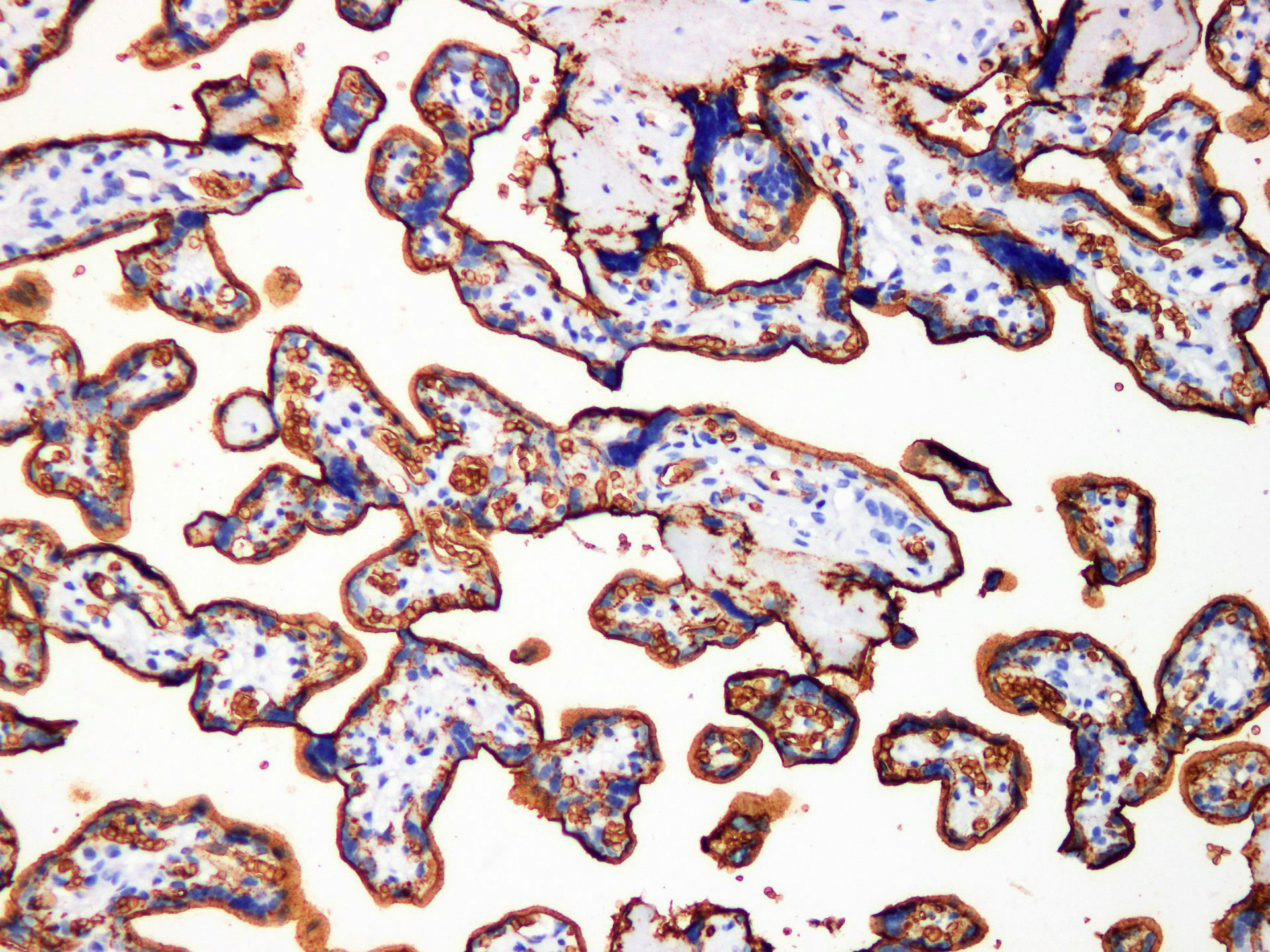 Pathological Antibodies