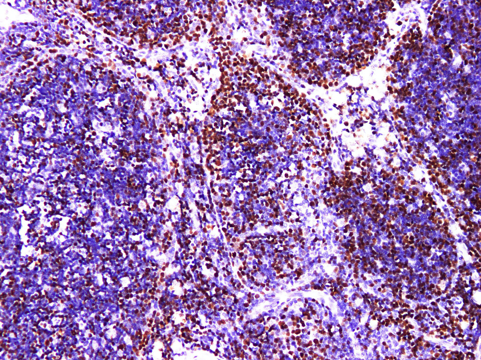 Pathological Antibodies