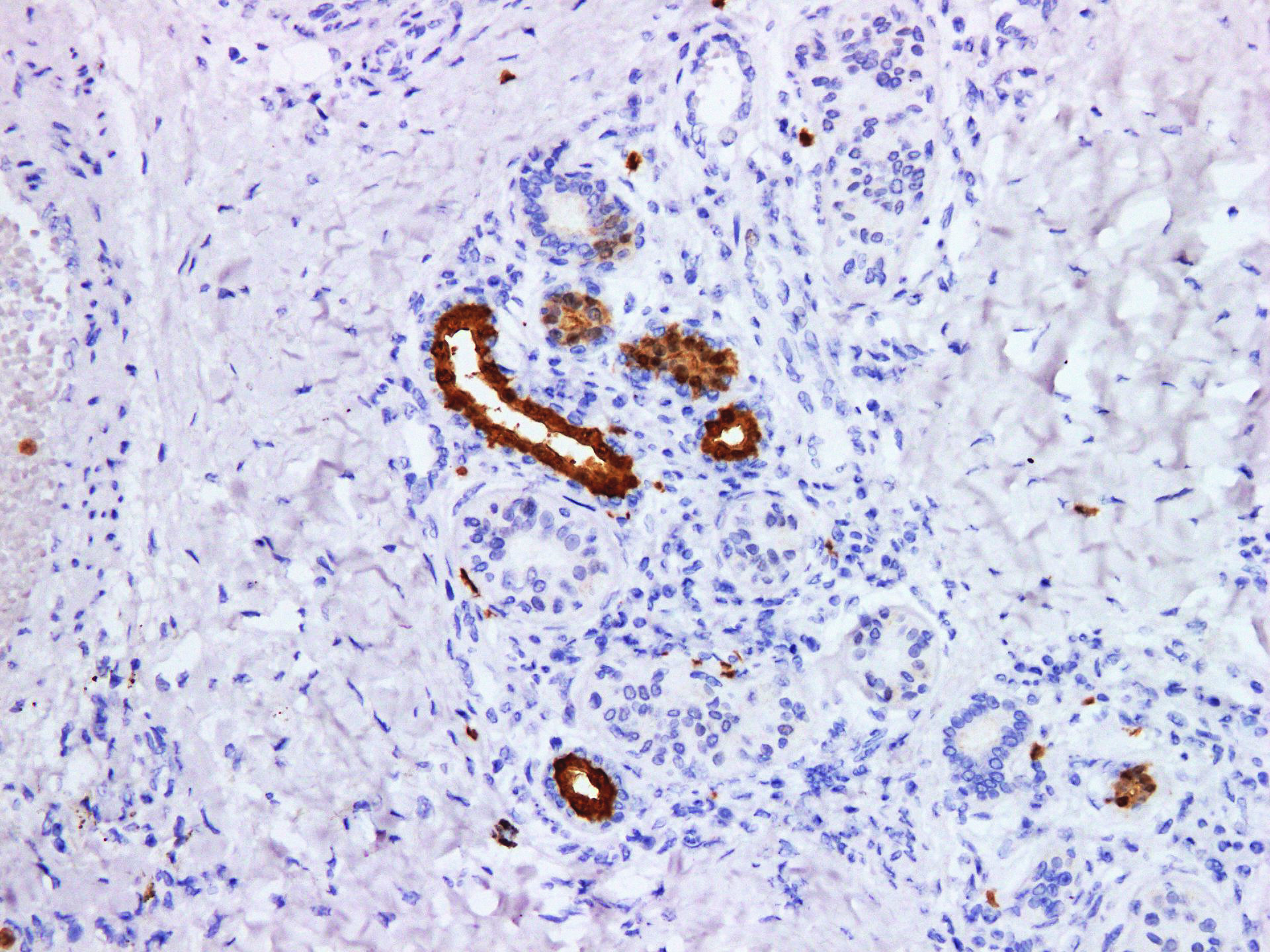 Pathological Antibodies