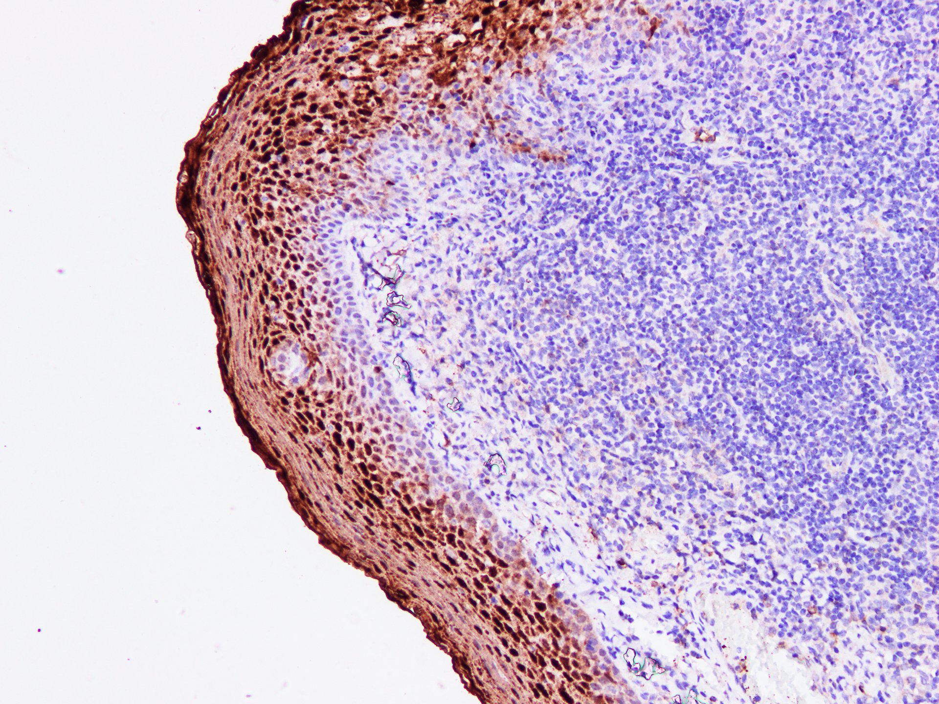 Pathological Antibodies