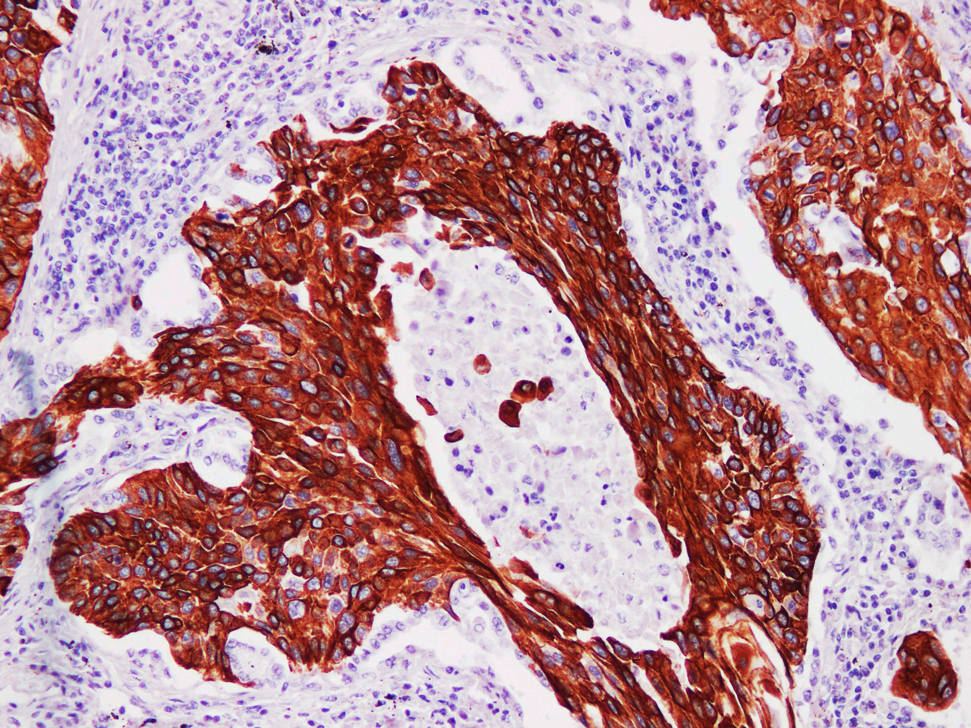 Pathological Antibodies