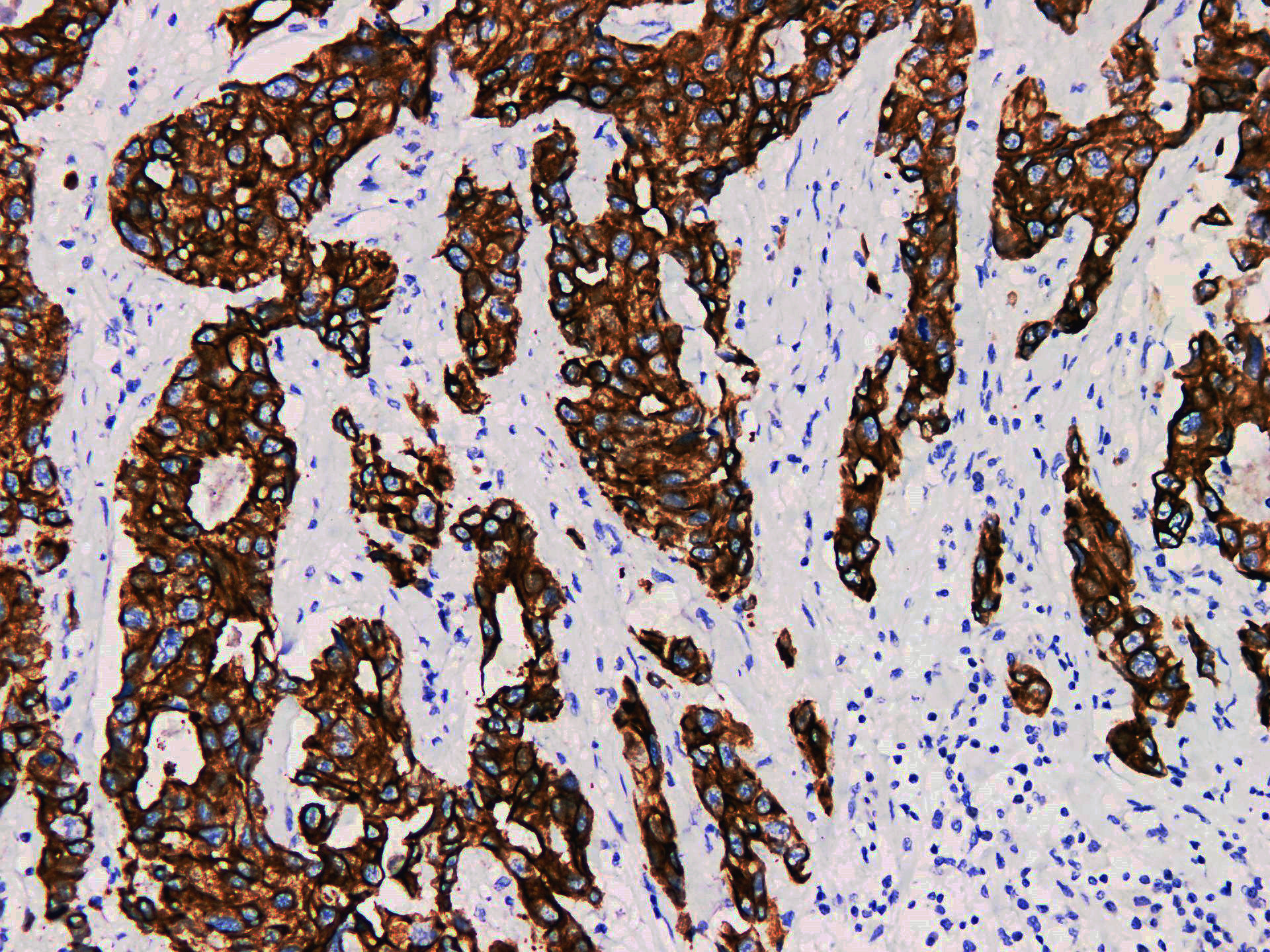 Pathological Antibodies