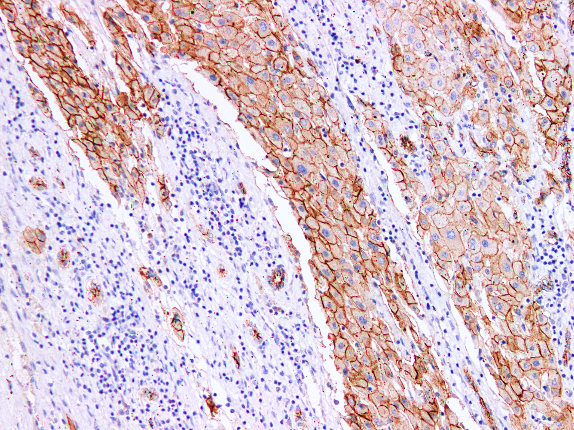 Pathological Antibodies