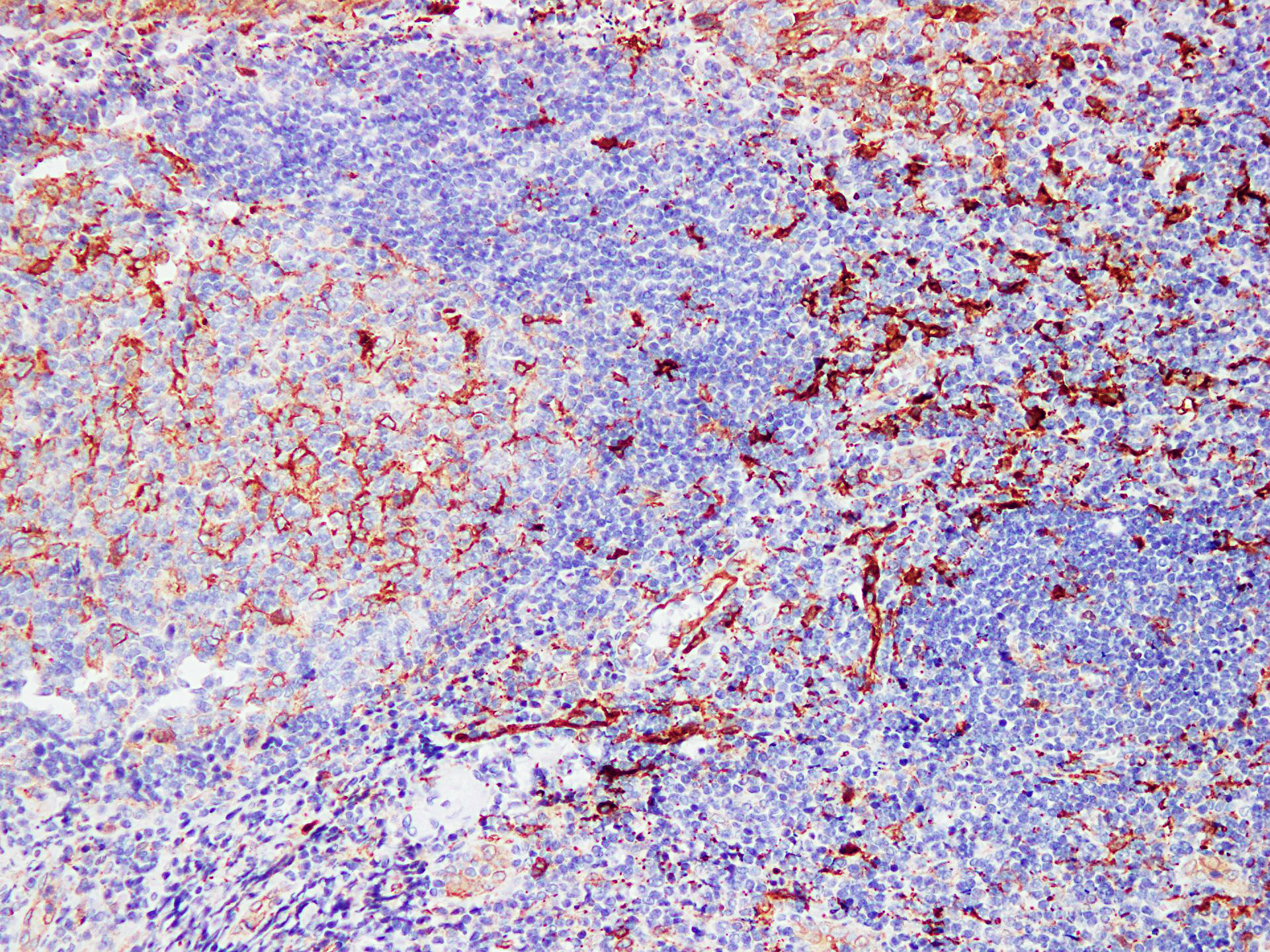 Pathological Antibodies