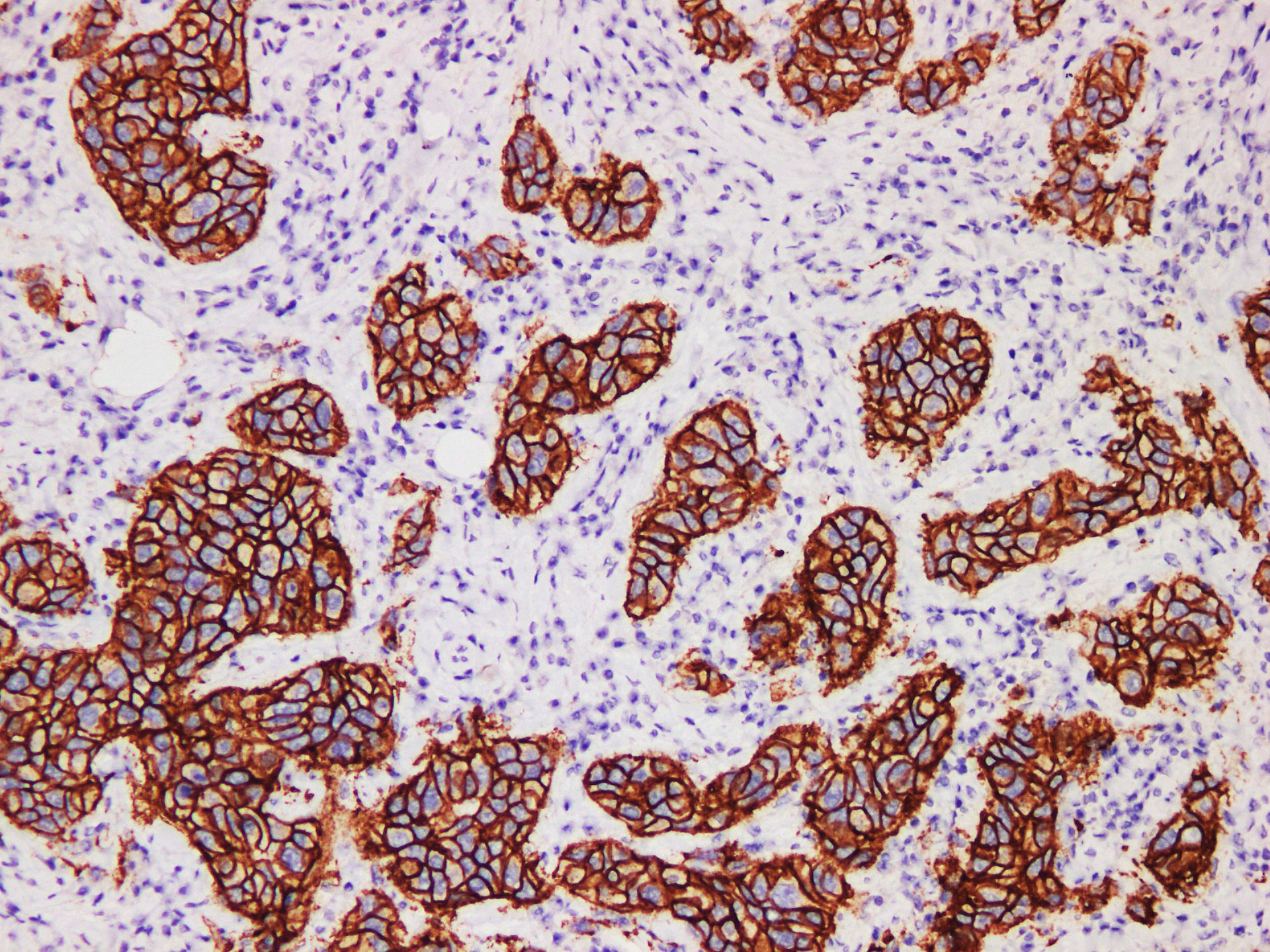 Pathological Antibodies