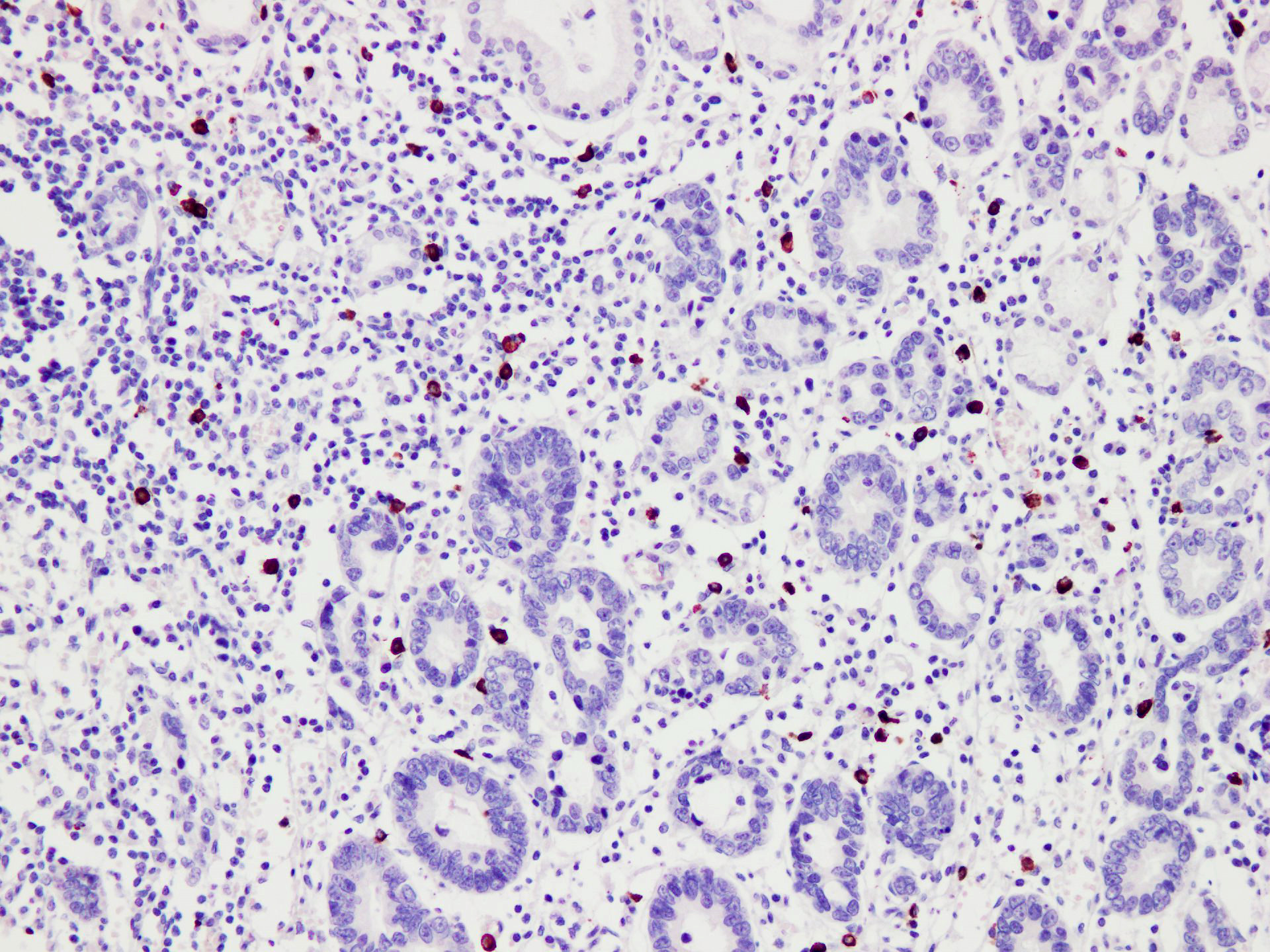 Pathological Antibodies